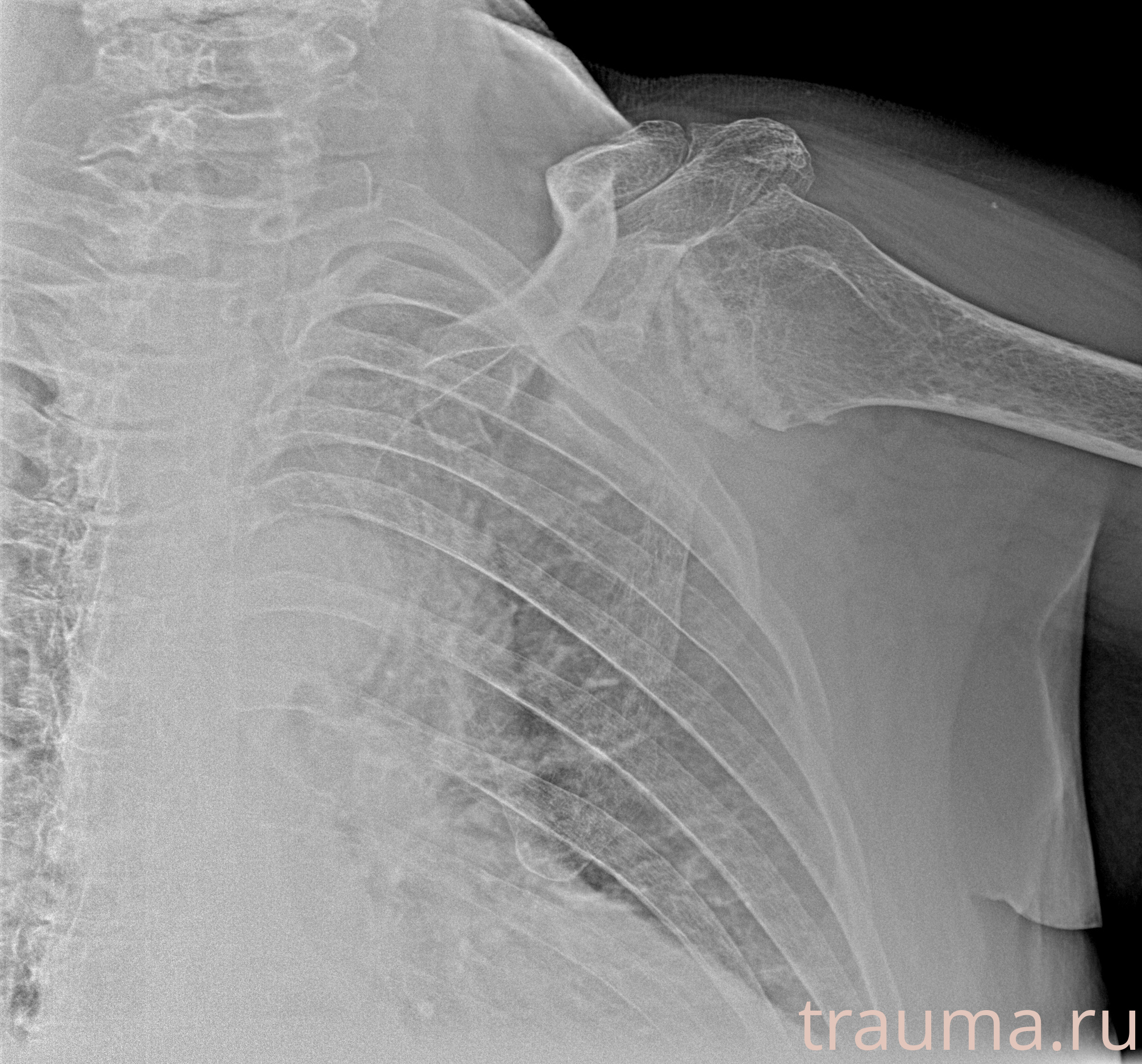 Рентген на дому: по вашему адресу приезжает врач-рентгенолог, травматолог-ортопед с мобильным рентгеновским аппаратом, проводит диагностику травмы или заболевания, делает необходимые рентгенограммы, дает рекомендации по дальнейшему лечению. Получить качественные снимки в домашних условиях возможно благодаря уникальной методике, разработанной МосРентген Центром для института  Склифосовского