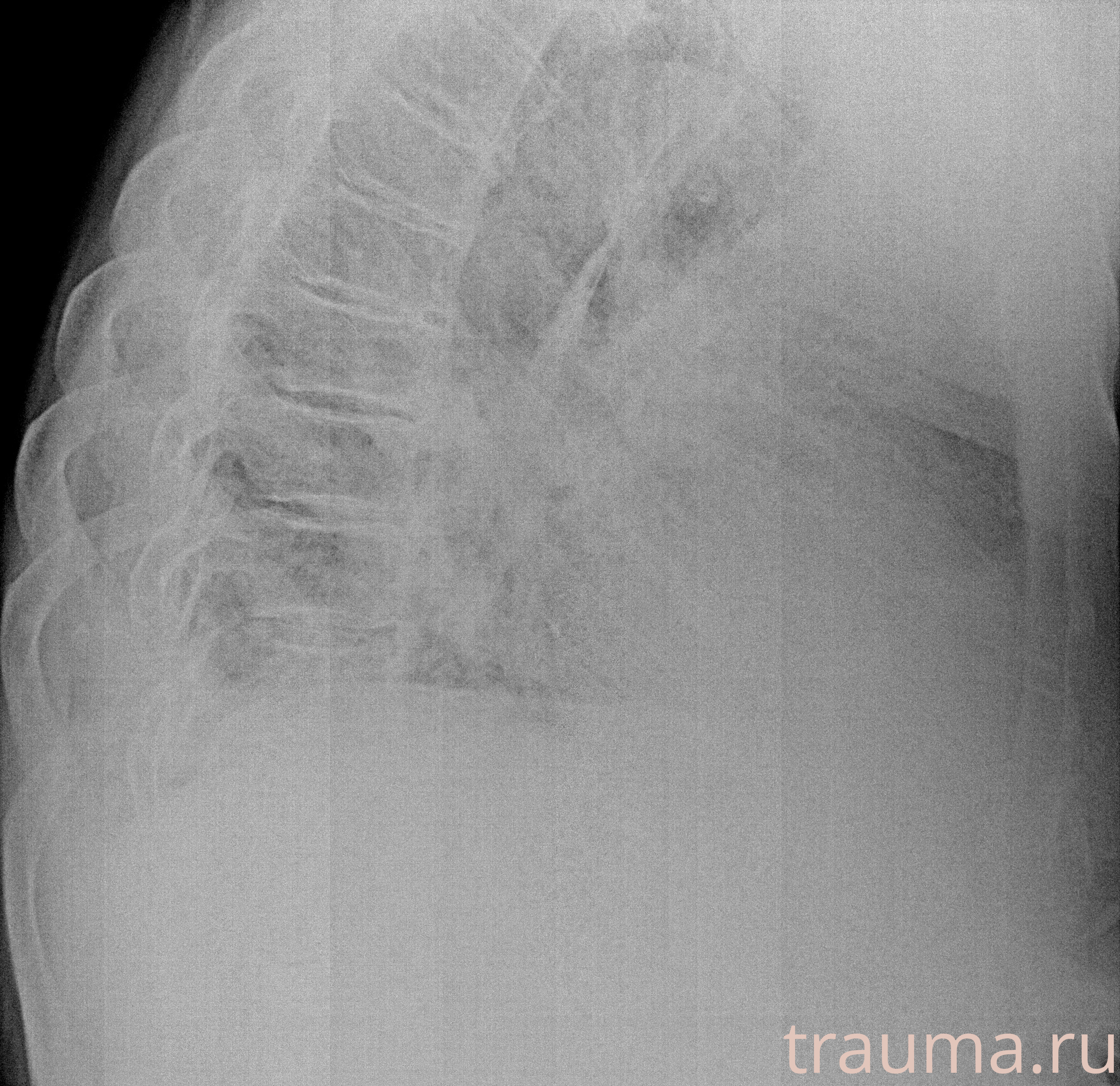 Рентген на дому: по вашему адресу приезжает врач-рентгенолог, травматолог-ортопед с мобильным рентгеновским аппаратом, проводит диагностику травмы или заболевания, делает необходимые рентгенограммы, дает рекомендации по дальнейшему лечению. Получить качественные снимки в домашних условиях возможно благодаря уникальной методике, разработанной МосРентген Центром для института  Склифосовского
