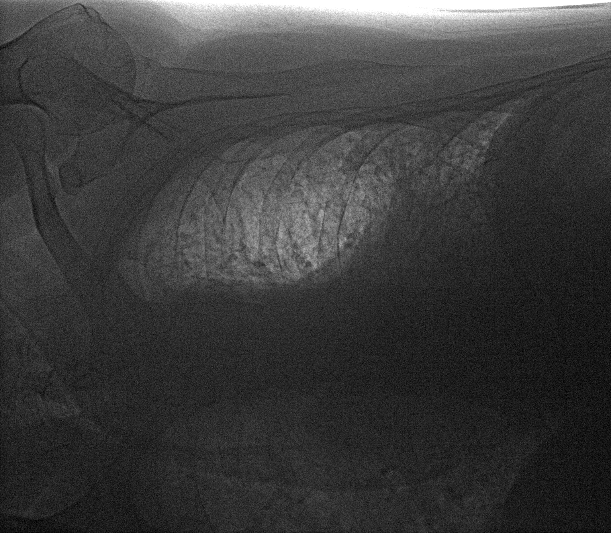 Рентген на дому: по вашему адресу приезжает врач-рентгенолог, травматолог-ортопед с мобильным рентгеновским аппаратом, проводит диагностику травмы или заболевания, делает необходимые рентгенограммы, дает рекомендации по дальнейшему лечению. Получить качественные снимки в домашних условиях возможно благодаря уникальной методике, разработанной МосРентген Центром для института  Склифосовского