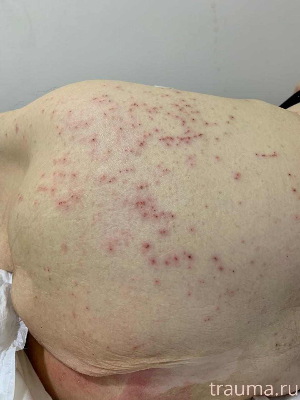 Рентген на дому: по вашему адресу приезжает врач-рентгенолог, травматолог-ортопед с мобильным рентгеновским аппаратом, проводит диагностику травмы или заболевания, делает необходимые рентгенограммы, дает рекомендации по дальнейшему лечению. Получить качественные снимки в домашних условиях возможно благодаря уникальной методике, разработанной МосРентген Центром для института  Склифосовского