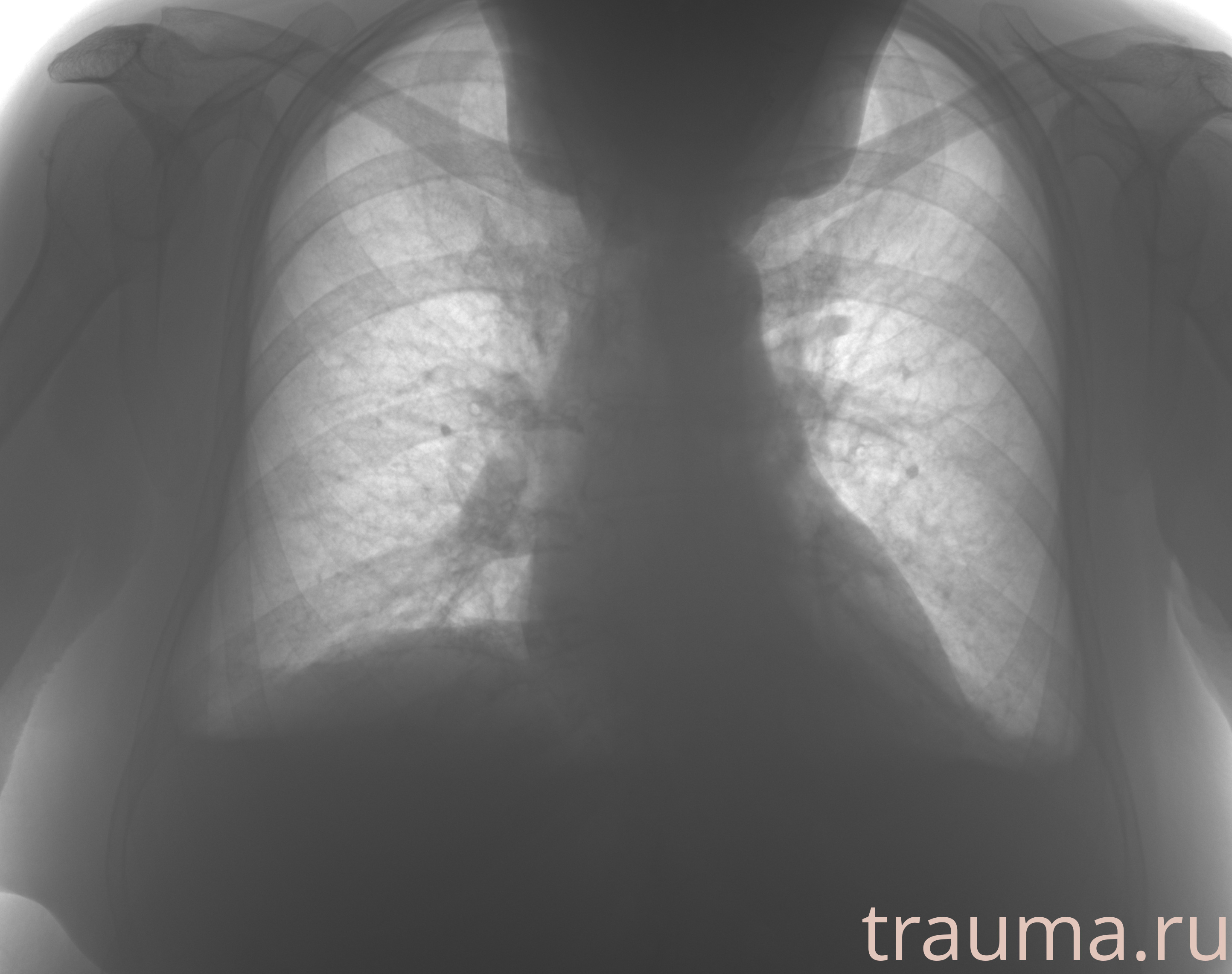 Рентген на дому: по вашему адресу приезжает врач-рентгенолог, травматолог-ортопед с мобильным рентгеновским аппаратом, проводит диагностику травмы или заболевания, делает необходимые рентгенограммы, дает рекомендации по дальнейшему лечению. Получить качественные снимки в домашних условиях возможно благодаря уникальной методике, разработанной МосРентген Центром для института  Склифосовского