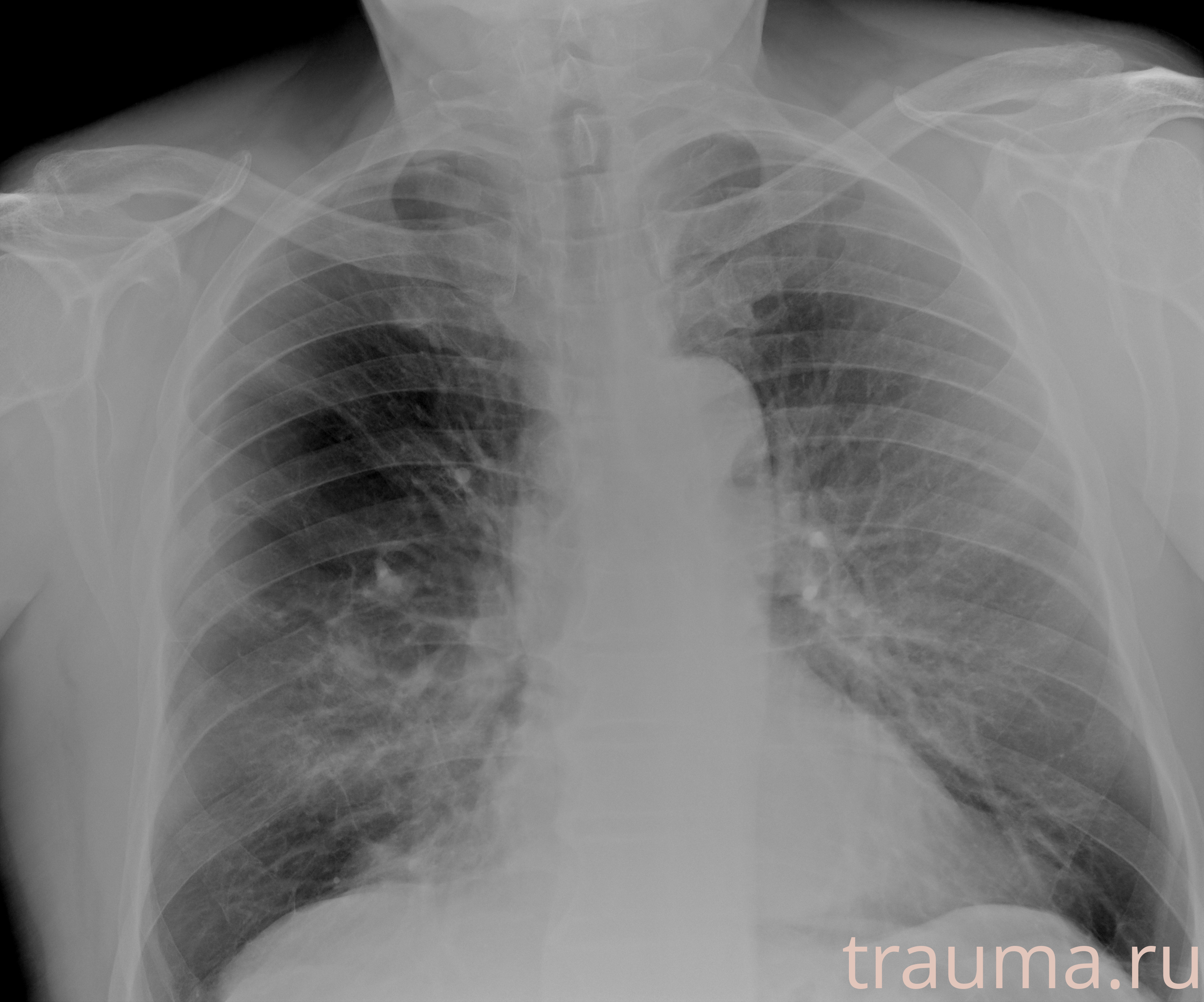 Рентген на дому: по вашему адресу приезжает врач-рентгенолог, травматолог-ортопед с мобильным рентгеновским аппаратом, проводит диагностику травмы или заболевания, делает необходимые рентгенограммы, дает рекомендации по дальнейшему лечению. Получить качественные снимки в домашних условиях возможно благодаря уникальной методике, разработанной МосРентген Центром для института  Склифосовского