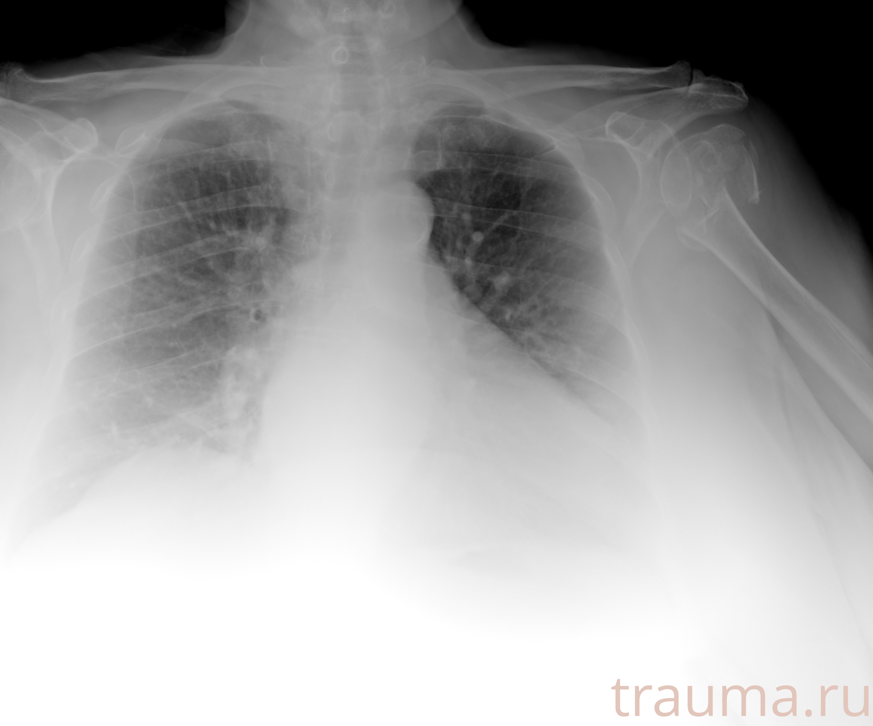 Рентген на дому: по вашему адресу приезжает врач-рентгенолог, травматолог-ортопед с мобильным рентгеновским аппаратом, проводит диагностику травмы или заболевания, делает необходимые рентгенограммы, дает рекомендации по дальнейшему лечению. Получить качественные снимки в домашних условиях возможно благодаря уникальной методике, разработанной МосРентген Центром для института  Склифосовского