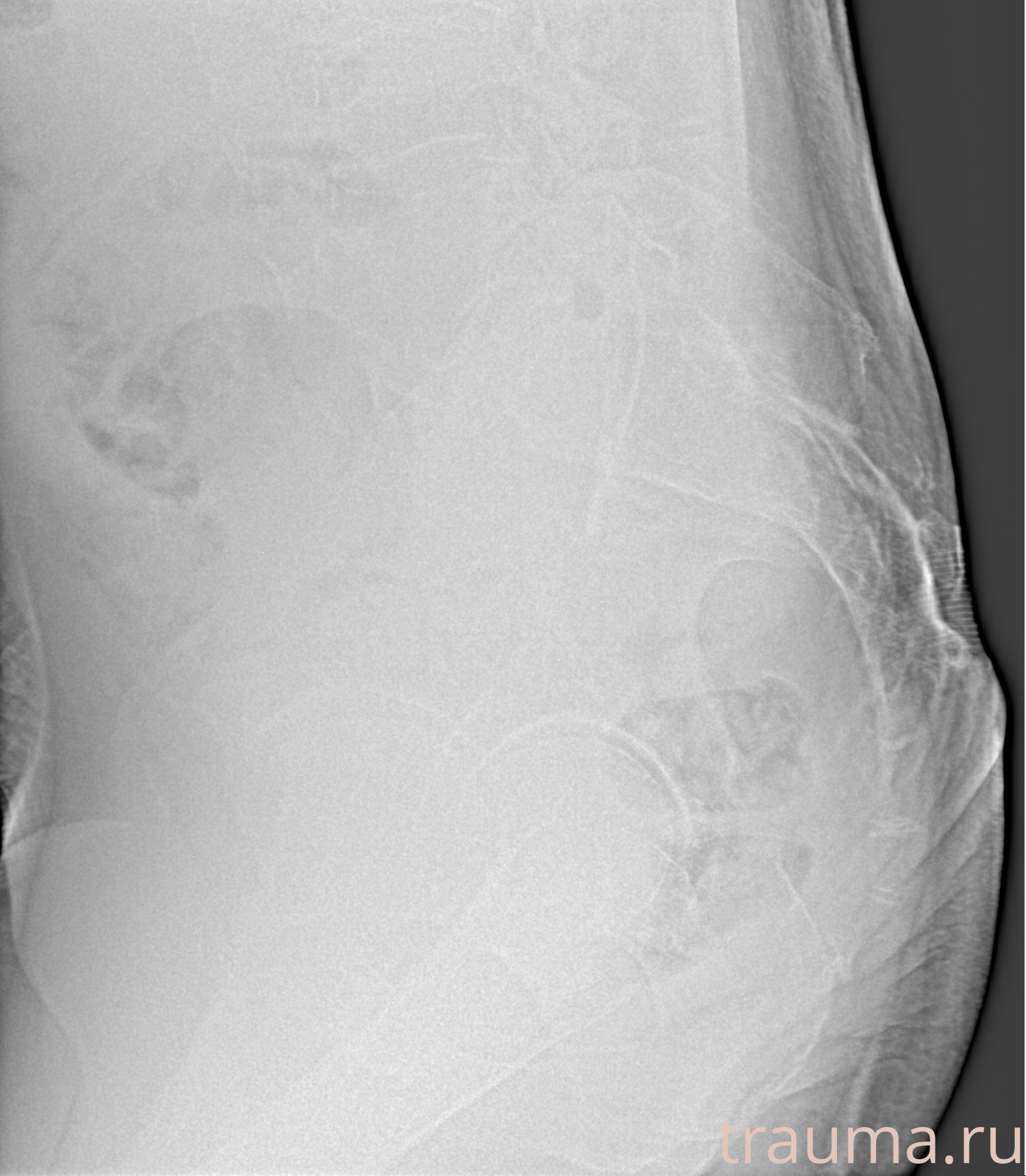 Рентген на дому: по вашему адресу приезжает врач-рентгенолог, травматолог-ортопед с мобильным рентгеновским аппаратом, проводит диагностику травмы или заболевания, делает необходимые рентгенограммы, дает рекомендации по дальнейшему лечению. Получить качественные снимки в домашних условиях возможно благодаря уникальной методике, разработанной МосРентген Центром для института  Склифосовского