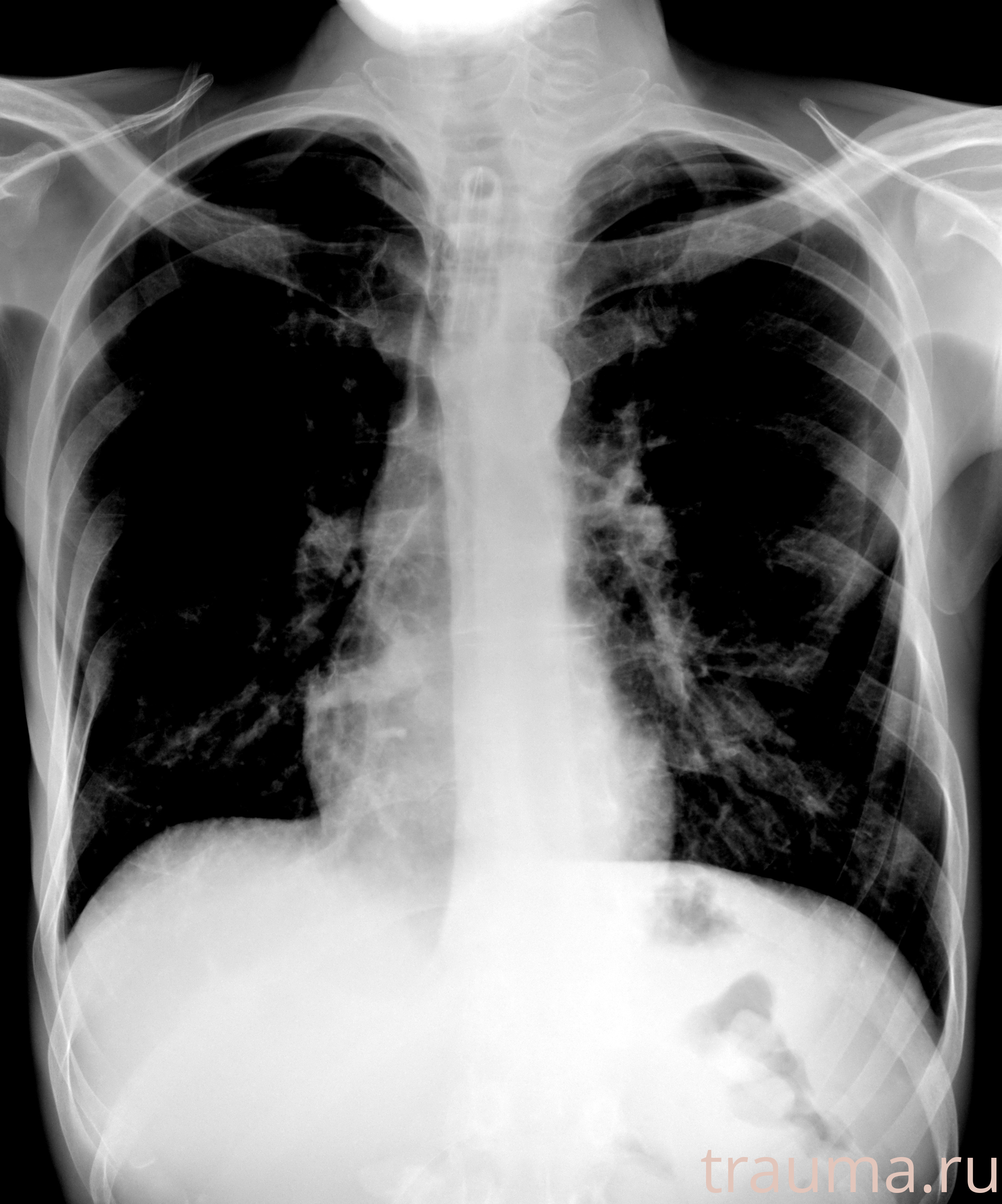 Рентген на дому: по вашему адресу приезжает врач-рентгенолог, травматолог-ортопед с мобильным рентгеновским аппаратом, проводит диагностику травмы или заболевания, делает необходимые рентгенограммы, дает рекомендации по дальнейшему лечению. Получить качественные снимки в домашних условиях возможно благодаря уникальной методике, разработанной МосРентген Центром для института  Склифосовского