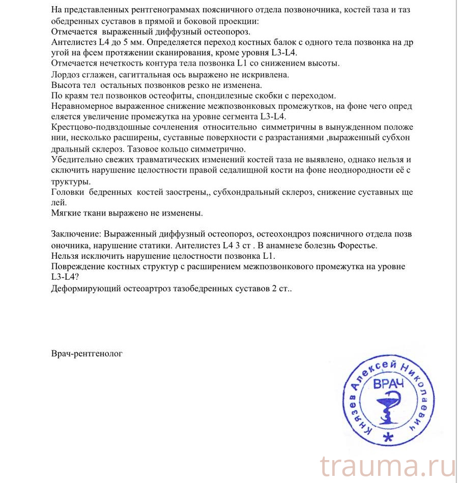 Рентген на дому: по вашему адресу приезжает врач-рентгенолог, травматолог-ортопед с мобильным рентгеновским аппаратом, проводит диагностику травмы или заболевания, делает необходимые рентгенограммы, дает рекомендации по дальнейшему лечению. Получить качественные снимки в домашних условиях возможно благодаря уникальной методике, разработанной МосРентген Центром для института  Склифосовского