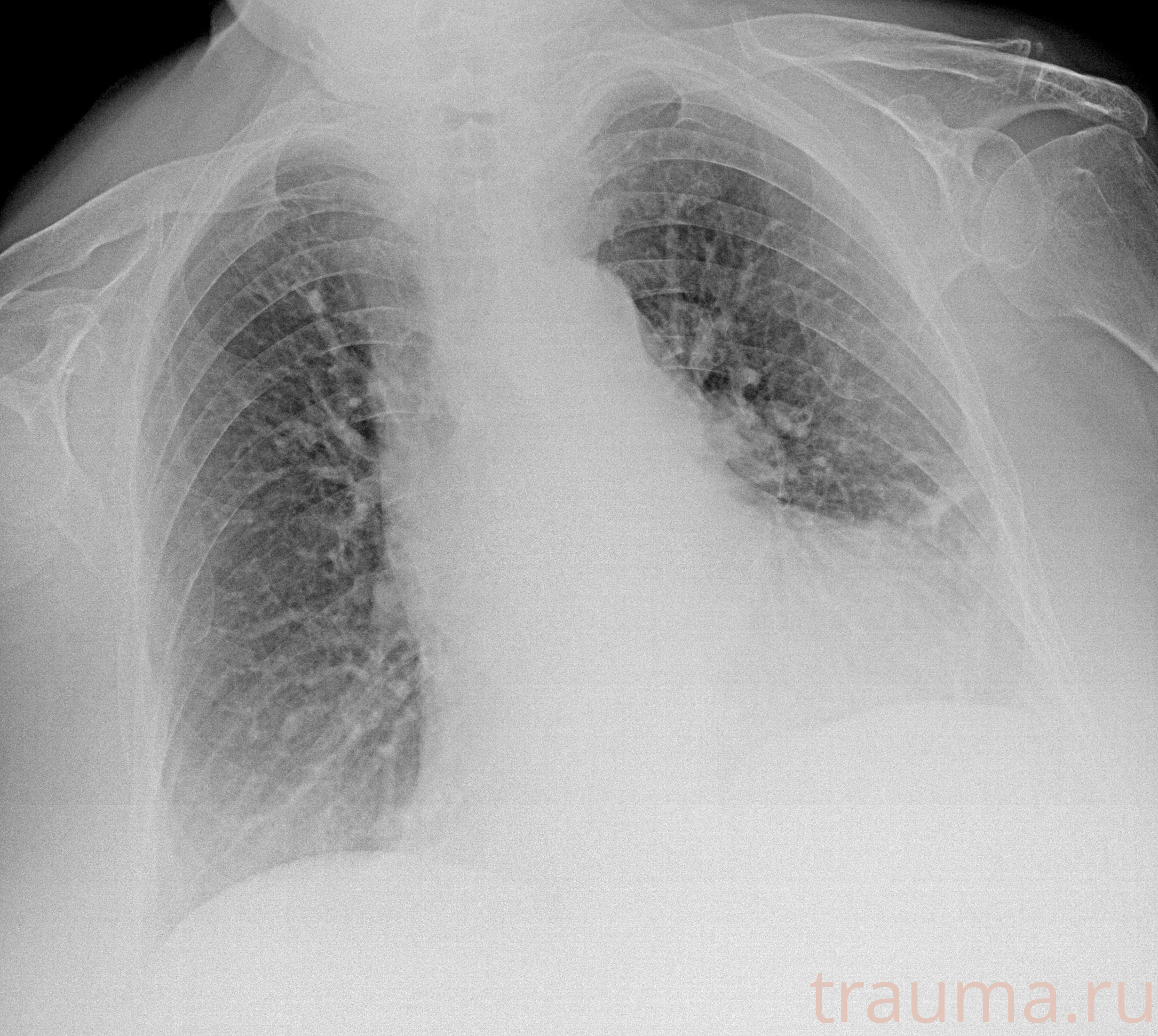 Рентген на дому: по вашему адресу приезжает врач-рентгенолог, травматолог-ортопед с мобильным рентгеновским аппаратом, проводит диагностику травмы или заболевания, делает необходимые рентгенограммы, дает рекомендации по дальнейшему лечению. Получить качественные снимки в домашних условиях возможно благодаря уникальной методике, разработанной МосРентген Центром для института  Склифосовского
