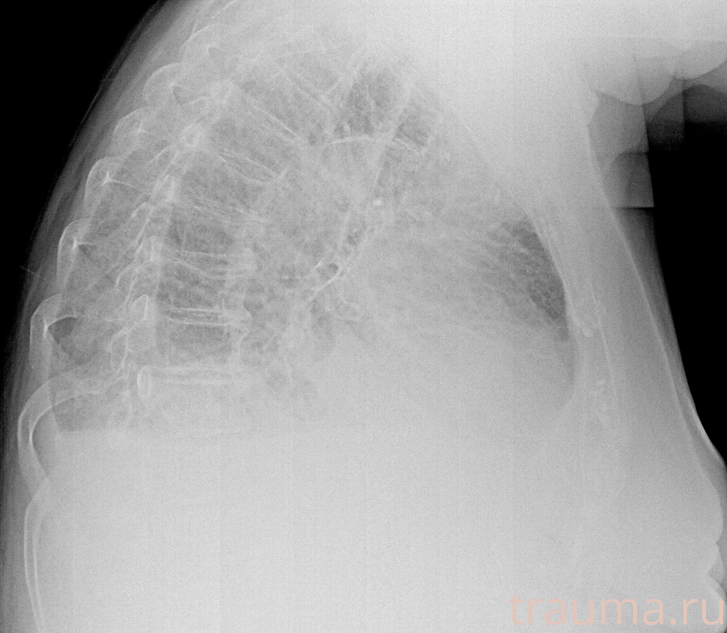 Рентген на дому: по вашему адресу приезжает врач-рентгенолог, травматолог-ортопед с мобильным рентгеновским аппаратом, проводит диагностику травмы или заболевания, делает необходимые рентгенограммы, дает рекомендации по дальнейшему лечению. Получить качественные снимки в домашних условиях возможно благодаря уникальной методике, разработанной МосРентген Центром для института  Склифосовского