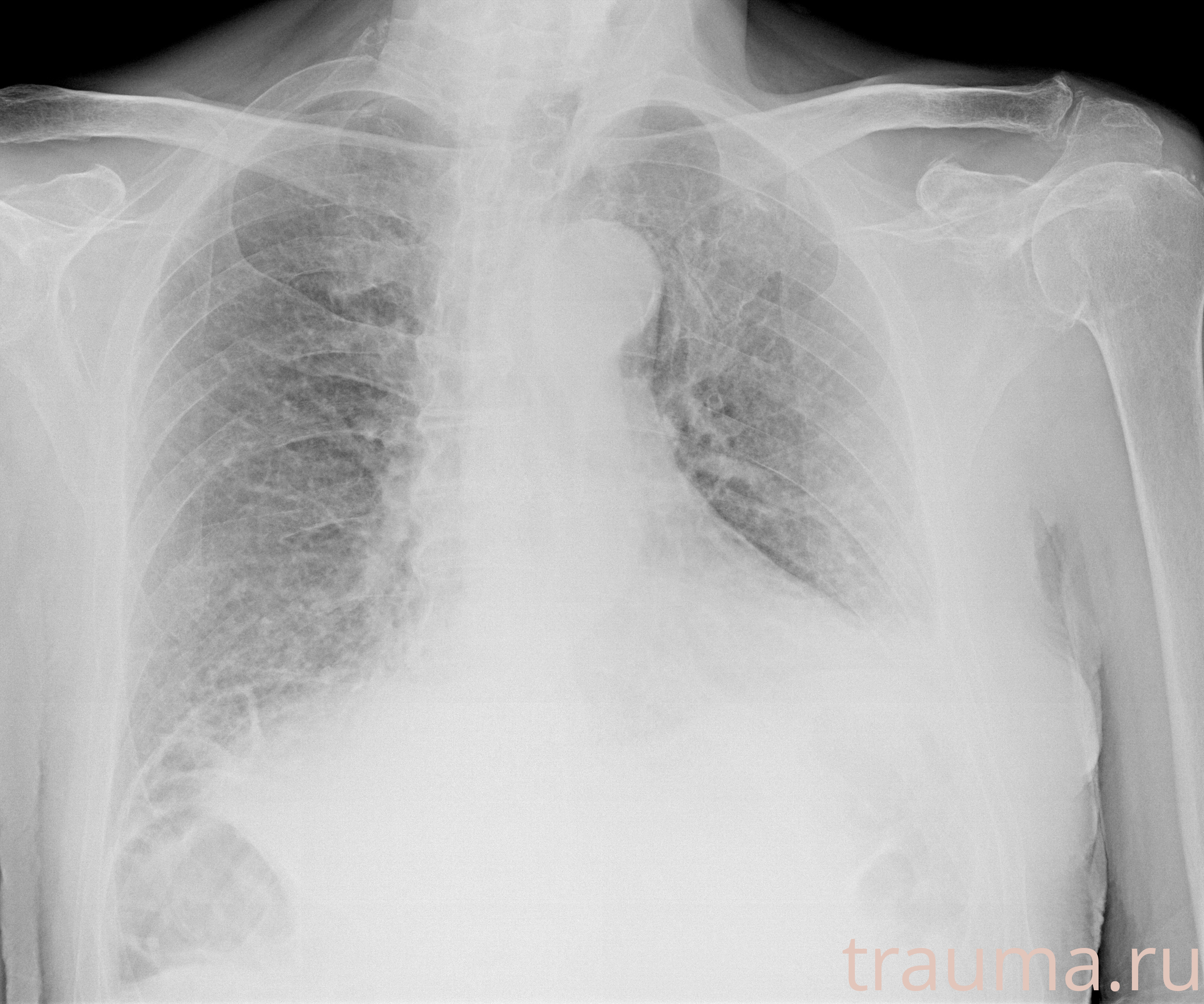 Рентген на дому: по вашему адресу приезжает врач-рентгенолог, травматолог-ортопед с мобильным рентгеновским аппаратом, проводит диагностику травмы или заболевания, делает необходимые рентгенограммы, дает рекомендации по дальнейшему лечению. Получить качественные снимки в домашних условиях возможно благодаря уникальной методике, разработанной МосРентген Центром для института  Склифосовского