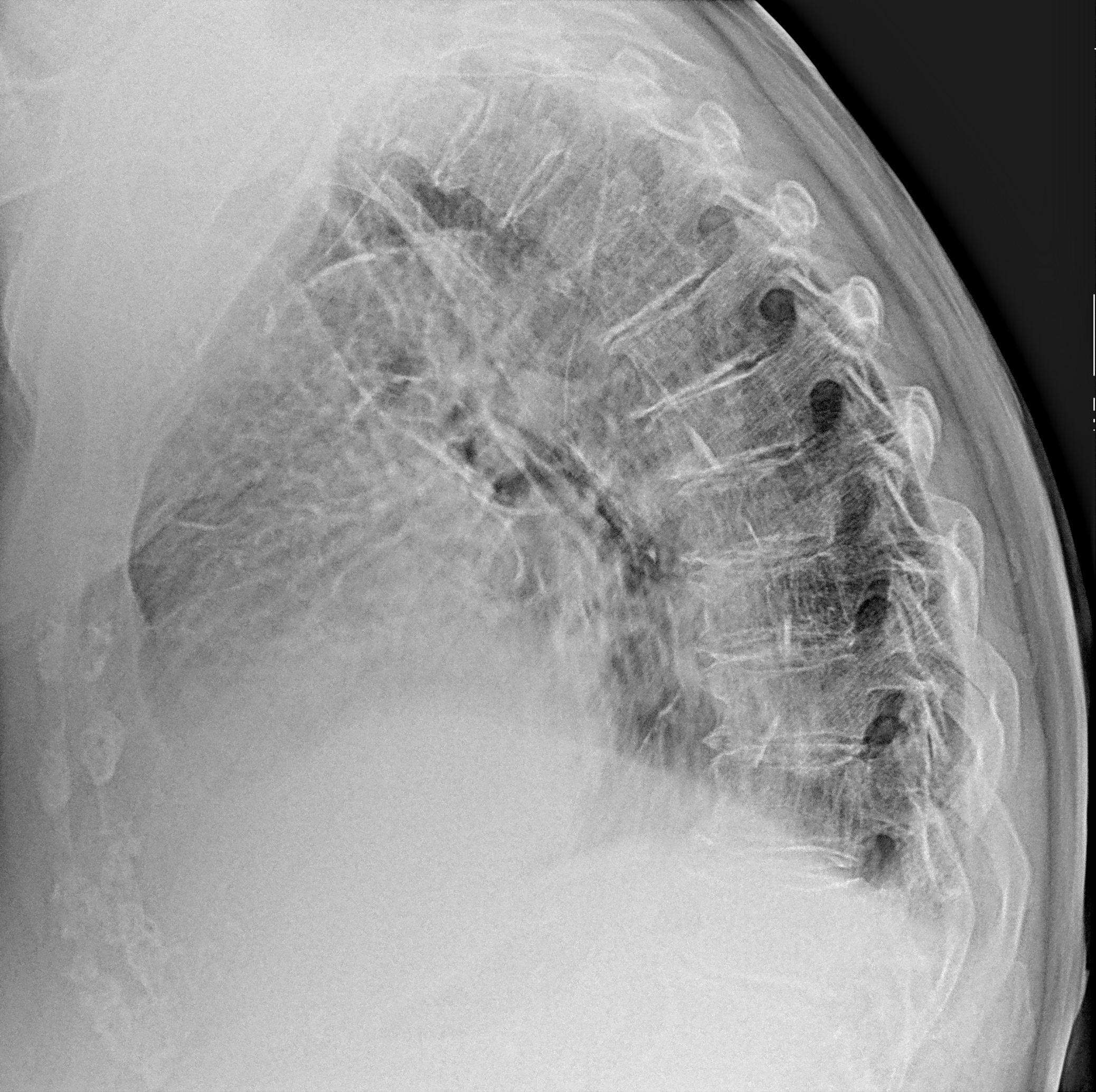 Рентген на дому: по вашему адресу приезжает врач-рентгенолог, травматолог-ортопед с мобильным рентгеновским аппаратом, проводит диагностику травмы или заболевания, делает необходимые рентгенограммы, дает рекомендации по дальнейшему лечению. Получить качественные снимки в домашних условиях возможно благодаря уникальной методике, разработанной МосРентген Центром для института  Склифосовского