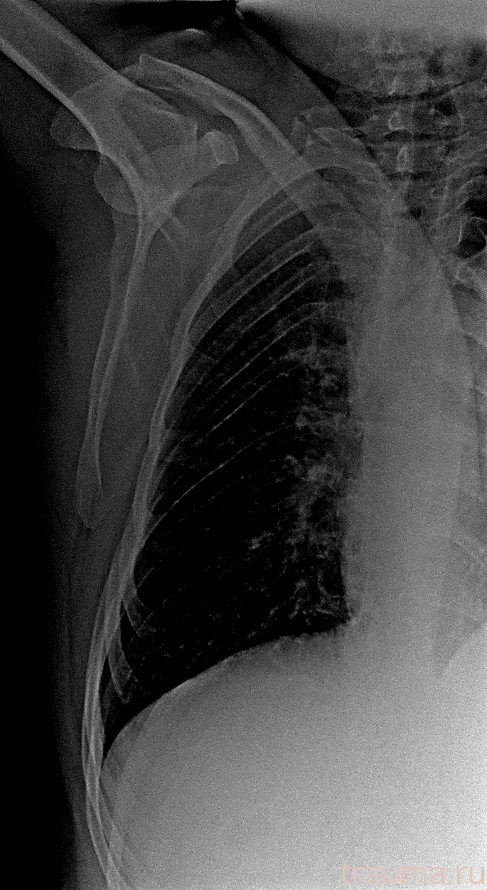 Рентген на дому: по вашему адресу приезжает врач-рентгенолог, травматолог-ортопед с мобильным рентгеновским аппаратом, проводит диагностику травмы или заболевания, делает необходимые рентгенограммы, дает рекомендации по дальнейшему лечению. Получить качественные снимки в домашних условиях возможно благодаря уникальной методике, разработанной МосРентген Центром для института  Склифосовского