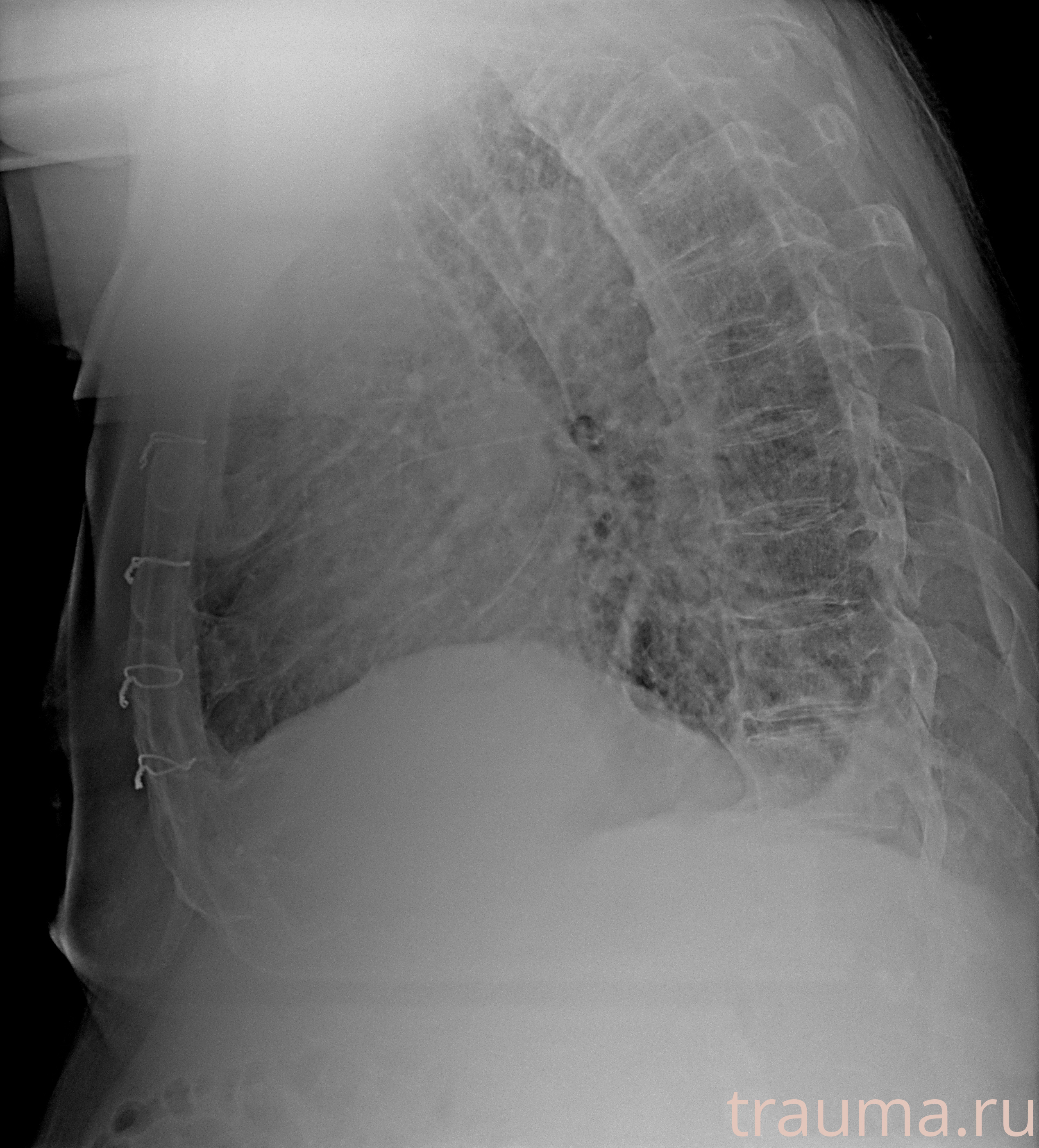 Рентген на дому: по вашему адресу приезжает врач-рентгенолог, травматолог-ортопед с мобильным рентгеновским аппаратом, проводит диагностику травмы или заболевания, делает необходимые рентгенограммы, дает рекомендации по дальнейшему лечению. Получить качественные снимки в домашних условиях возможно благодаря уникальной методике, разработанной МосРентген Центром для института  Склифосовского
