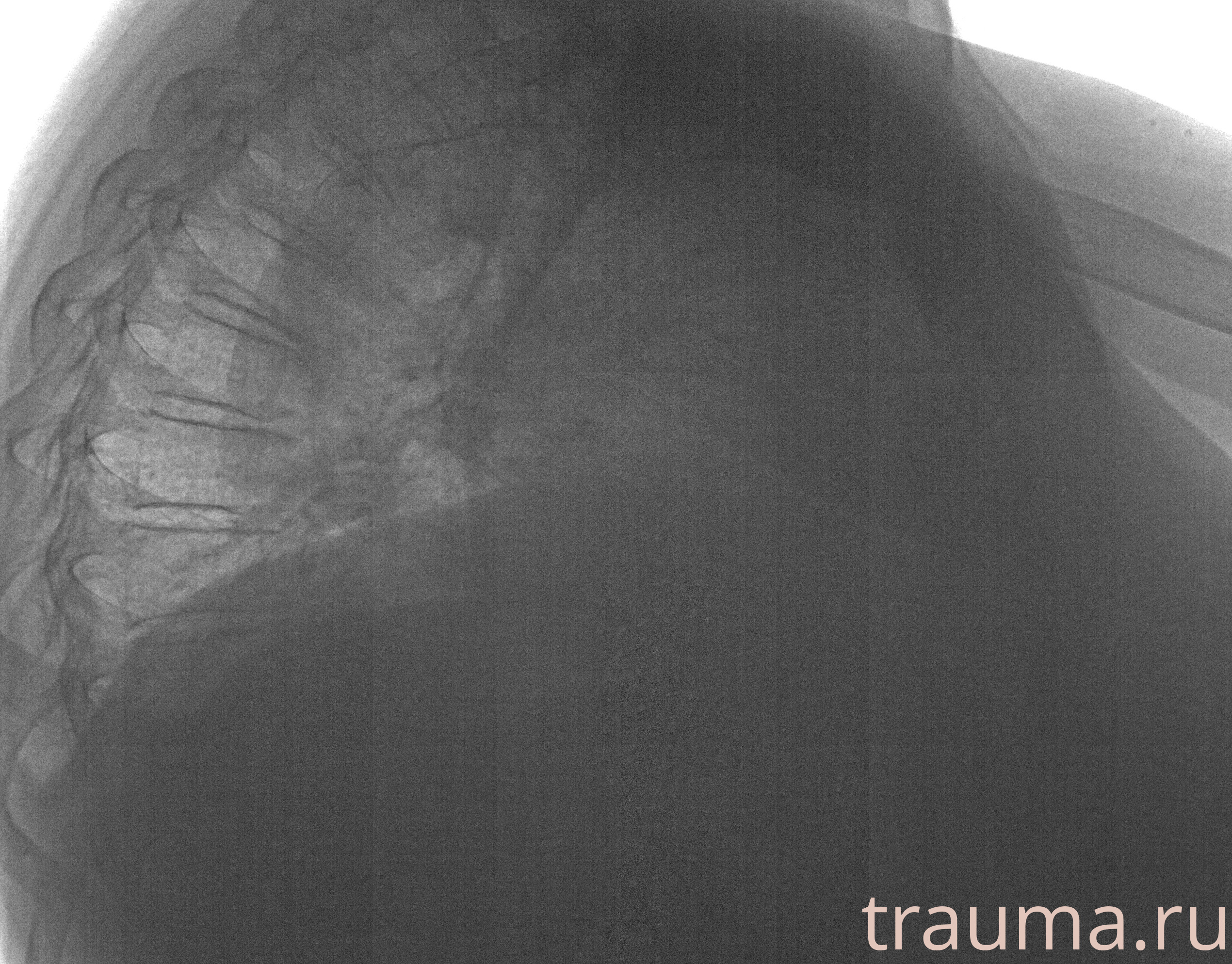 Рентген на дому: по вашему адресу приезжает врач-рентгенолог, травматолог-ортопед с мобильным рентгеновским аппаратом, проводит диагностику травмы или заболевания, делает необходимые рентгенограммы, дает рекомендации по дальнейшему лечению. Получить качественные снимки в домашних условиях возможно благодаря уникальной методике, разработанной МосРентген Центром для института  Склифосовского