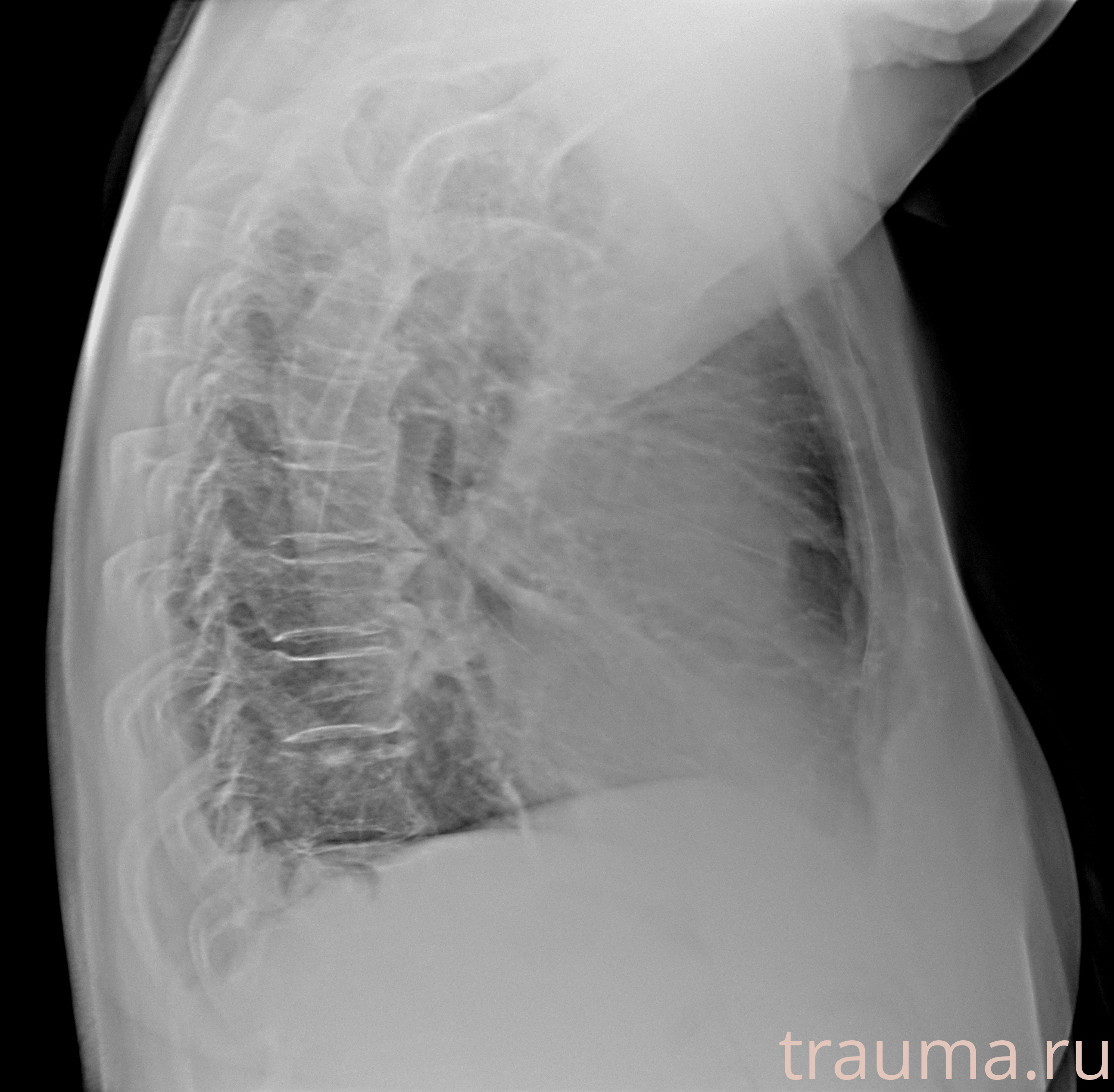 Рентген на дому: по вашему адресу приезжает врач-рентгенолог, травматолог-ортопед с мобильным рентгеновским аппаратом, проводит диагностику травмы или заболевания, делает необходимые рентгенограммы, дает рекомендации по дальнейшему лечению. Получить качественные снимки в домашних условиях возможно благодаря уникальной методике, разработанной МосРентген Центром для института  Склифосовского