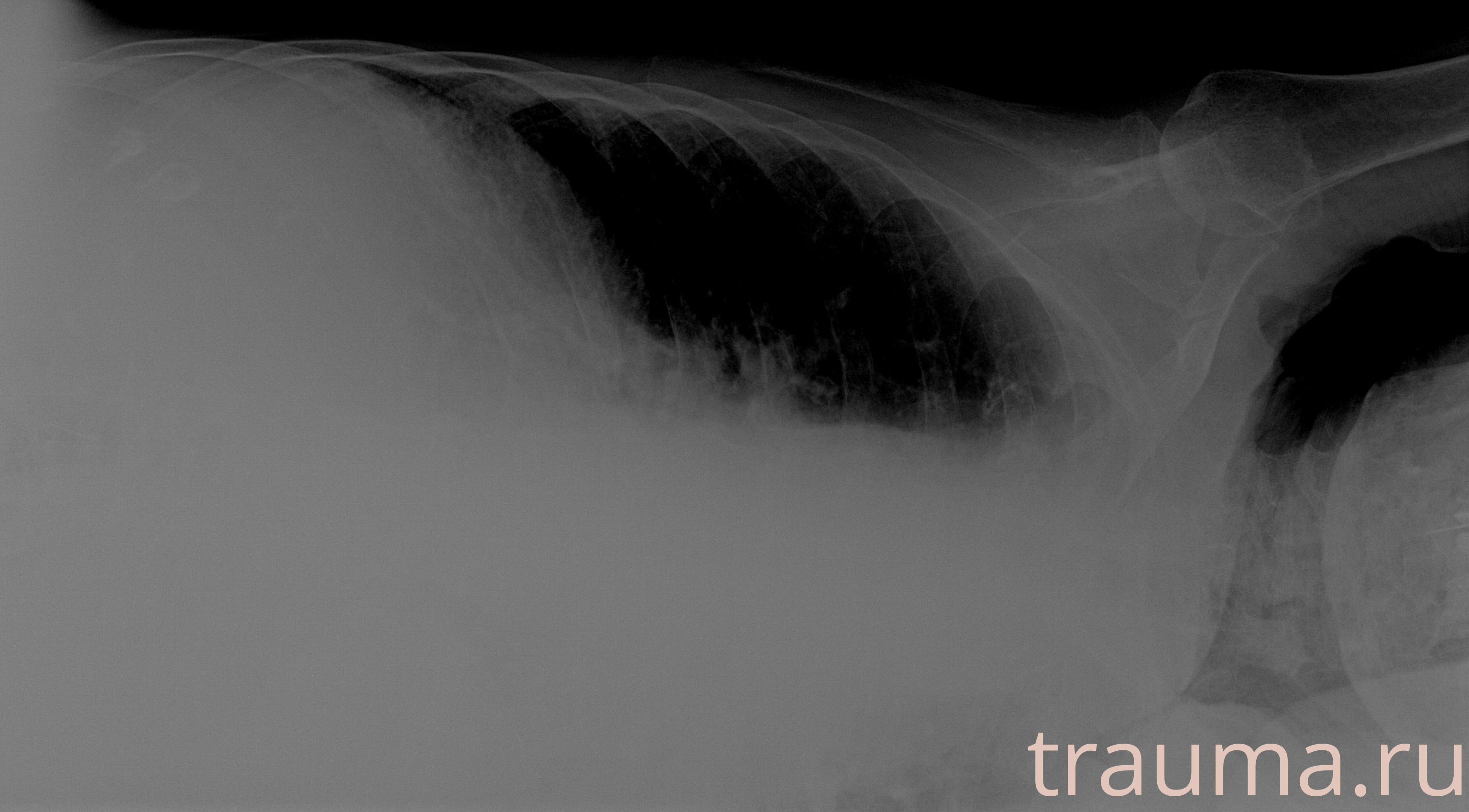 Рентген на дому: по вашему адресу приезжает врач-рентгенолог, травматолог-ортопед с мобильным рентгеновским аппаратом, проводит диагностику травмы или заболевания, делает необходимые рентгенограммы, дает рекомендации по дальнейшему лечению. Получить качественные снимки в домашних условиях возможно благодаря уникальной методике, разработанной МосРентген Центром для института  Склифосовского