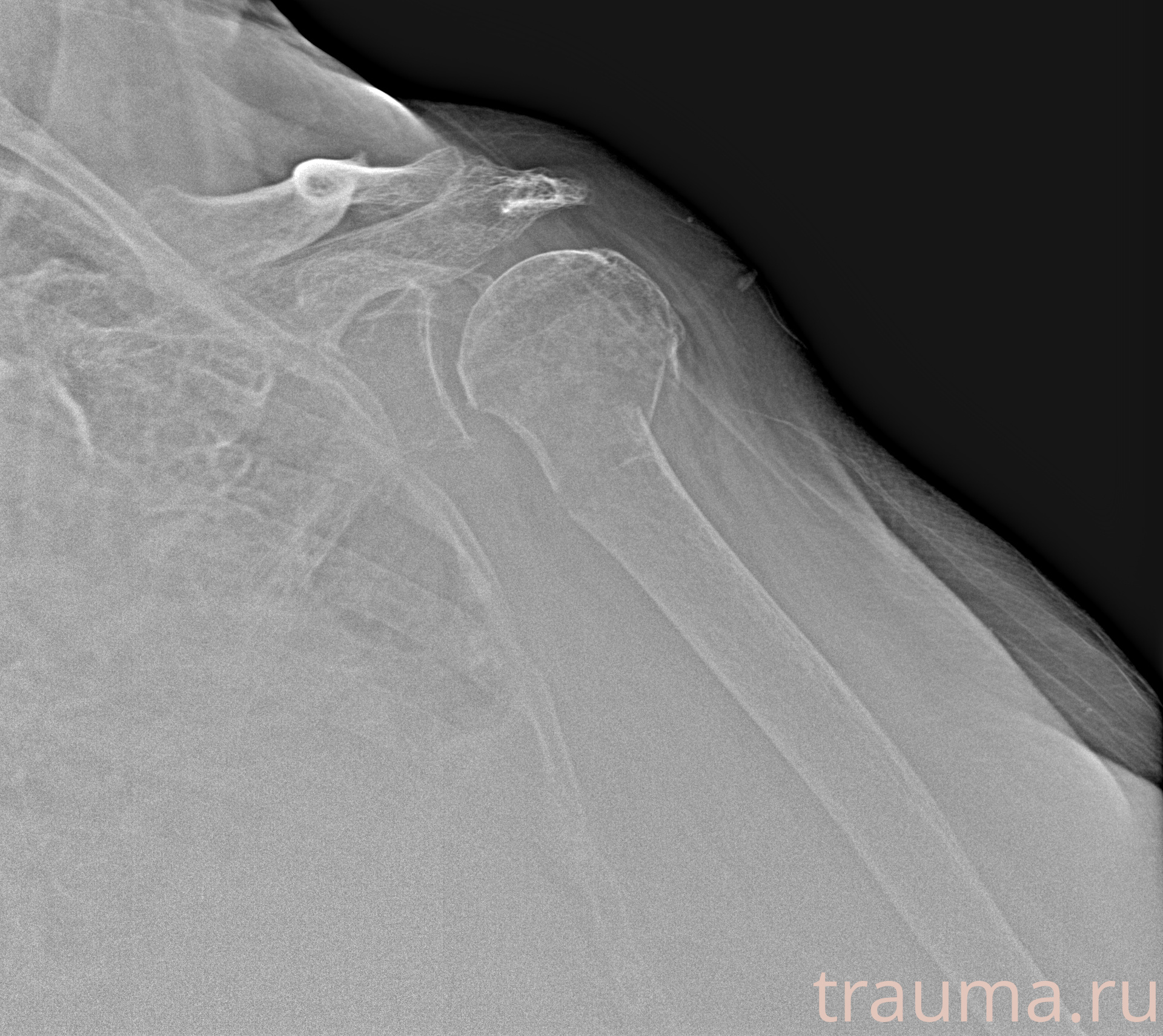 Рентген на дому: по вашему адресу приезжает врач-рентгенолог, травматолог-ортопед с мобильным рентгеновским аппаратом, проводит диагностику травмы или заболевания, делает необходимые рентгенограммы, дает рекомендации по дальнейшему лечению. Получить качественные снимки в домашних условиях возможно благодаря уникальной методике, разработанной МосРентген Центром для института  Склифосовского