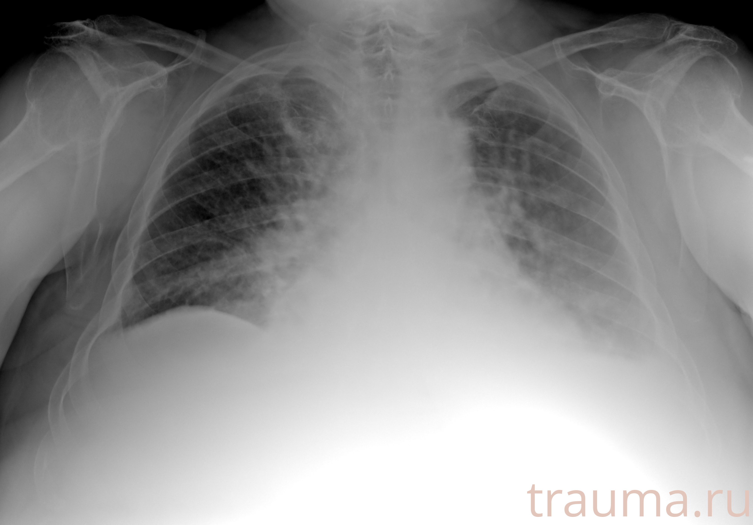 Рентген на дому: по вашему адресу приезжает врач-рентгенолог, травматолог-ортопед с мобильным рентгеновским аппаратом, проводит диагностику травмы или заболевания, делает необходимые рентгенограммы, дает рекомендации по дальнейшему лечению. Получить качественные снимки в домашних условиях возможно благодаря уникальной методике, разработанной МосРентген Центром для института  Склифосовского