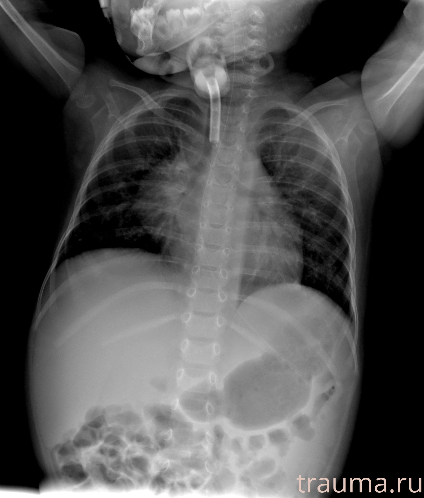 Рентген на дому: по вашему адресу приезжает врач-рентгенолог, травматолог-ортопед с мобильным рентгеновским аппаратом, проводит диагностику травмы или заболевания, делает необходимые рентгенограммы, дает рекомендации по дальнейшему лечению. Получить качественные снимки в домашних условиях возможно благодаря уникальной методике, разработанной МосРентген Центром для института  Склифосовского