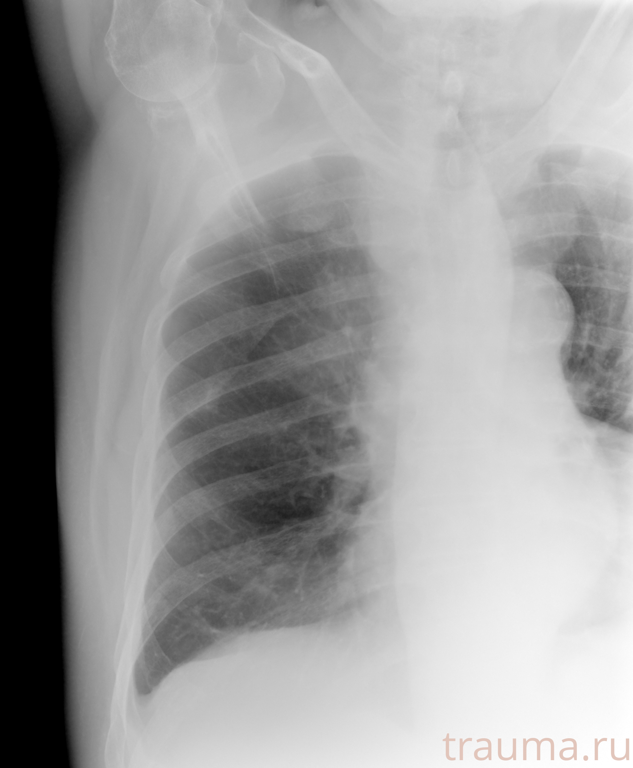 Рентген на дому: по вашему адресу приезжает врач-рентгенолог, травматолог-ортопед с мобильным рентгеновским аппаратом, проводит диагностику травмы или заболевания, делает необходимые рентгенограммы, дает рекомендации по дальнейшему лечению. Получить качественные снимки в домашних условиях возможно благодаря уникальной методике, разработанной МосРентген Центром для института  Склифосовского