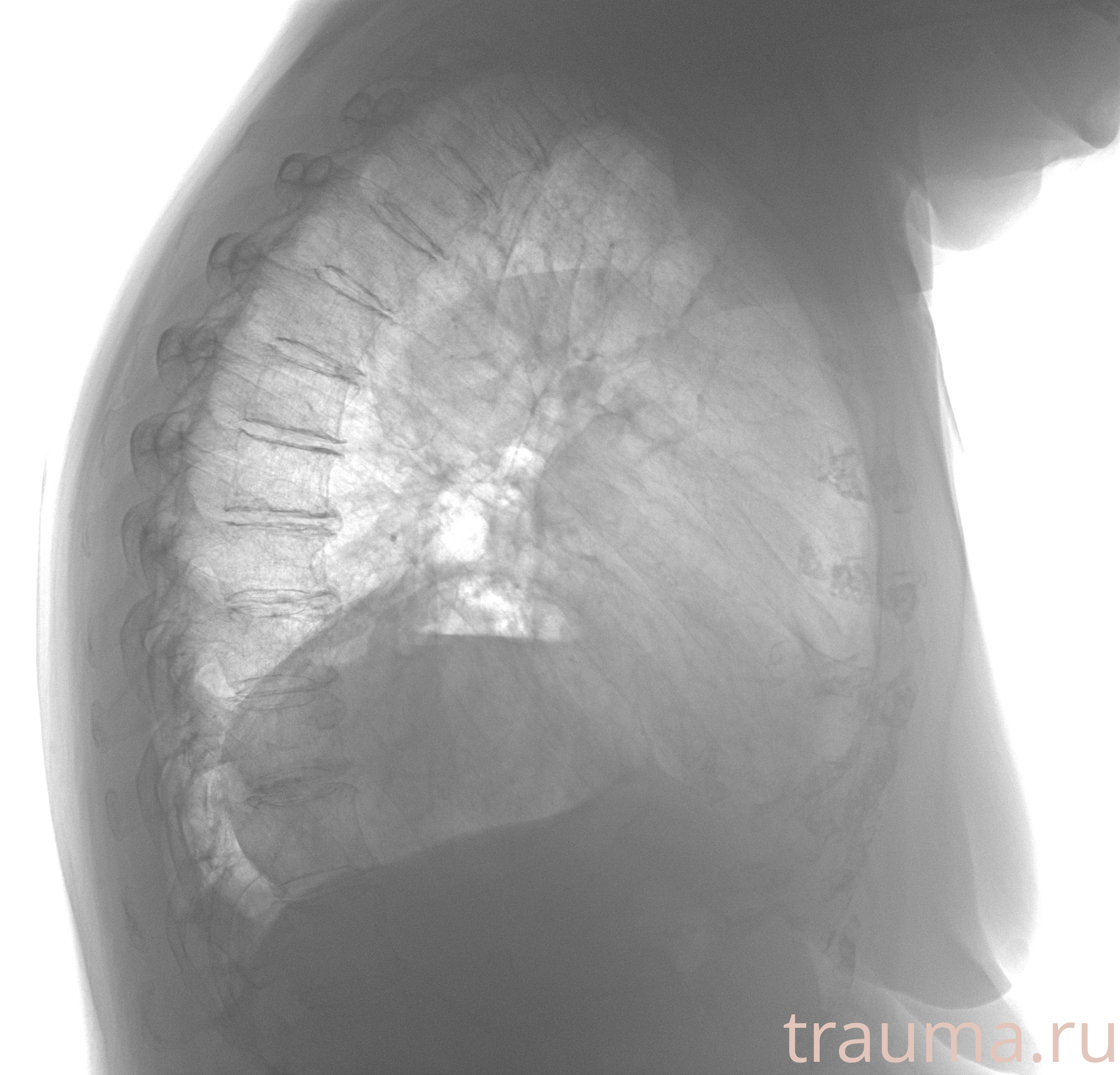 Рентген на дому: по вашему адресу приезжает врач-рентгенолог, травматолог-ортопед с мобильным рентгеновским аппаратом, проводит диагностику травмы или заболевания, делает необходимые рентгенограммы, дает рекомендации по дальнейшему лечению. Получить качественные снимки в домашних условиях возможно благодаря уникальной методике, разработанной МосРентген Центром для института  Склифосовского