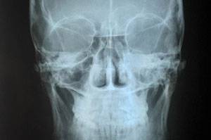 Оказание помощи раненым в лицо Оказание помощи раненым в лицо