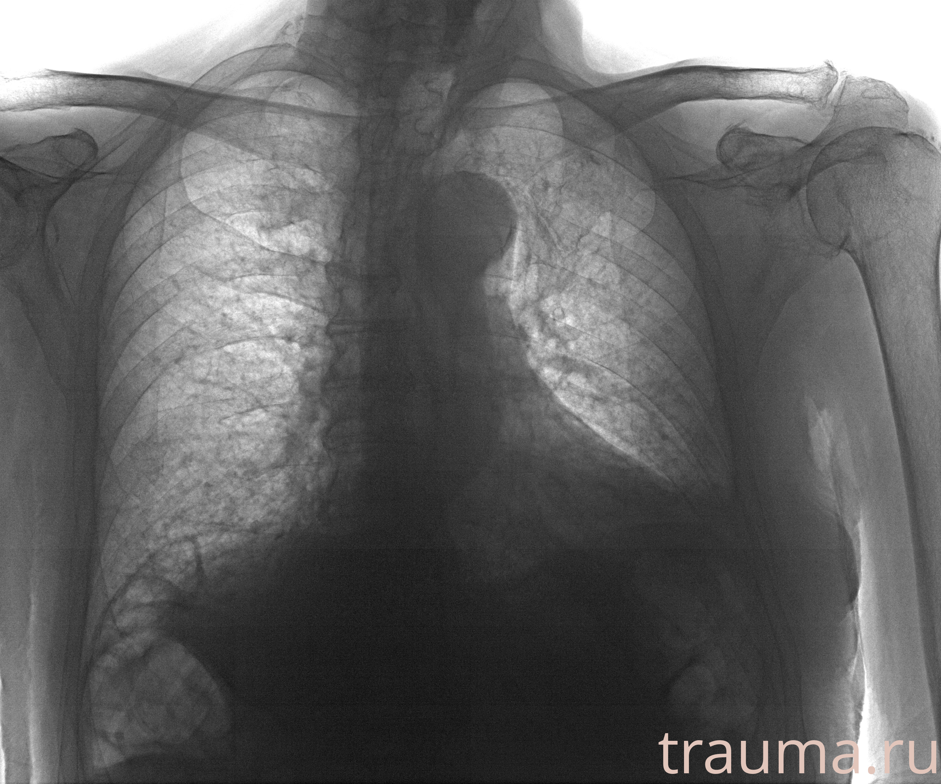 Рентген на дому: по вашему адресу приезжает врач-рентгенолог, травматолог-ортопед с мобильным рентгеновским аппаратом, проводит диагностику травмы или заболевания, делает необходимые рентгенограммы, дает рекомендации по дальнейшему лечению. Получить качественные снимки в домашних условиях возможно благодаря уникальной методике, разработанной МосРентген Центром для института  Склифосовского