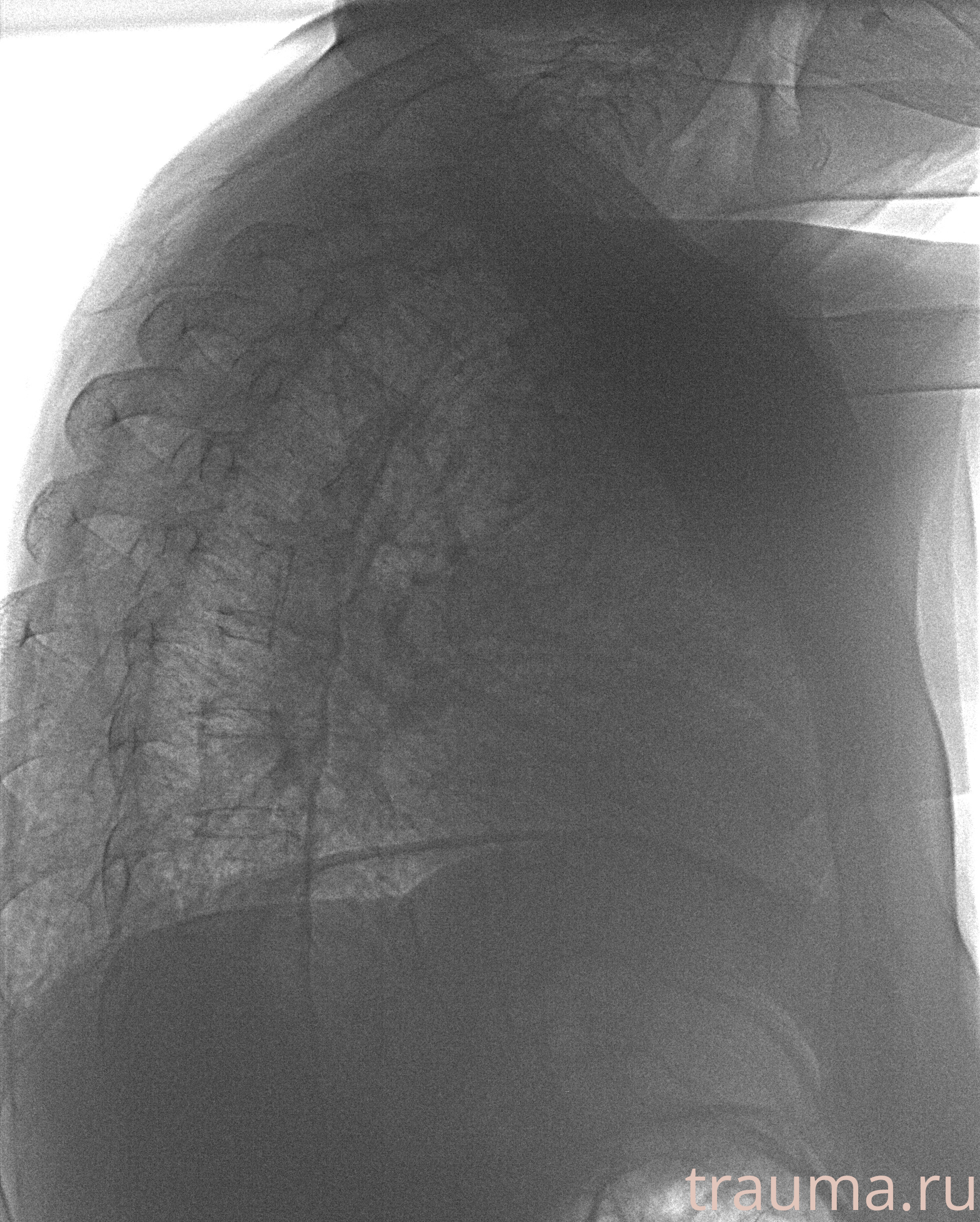 Рентген на дому: по вашему адресу приезжает врач-рентгенолог, травматолог-ортопед с мобильным рентгеновским аппаратом, проводит диагностику травмы или заболевания, делает необходимые рентгенограммы, дает рекомендации по дальнейшему лечению. Получить качественные снимки в домашних условиях возможно благодаря уникальной методике, разработанной МосРентген Центром для института  Склифосовского