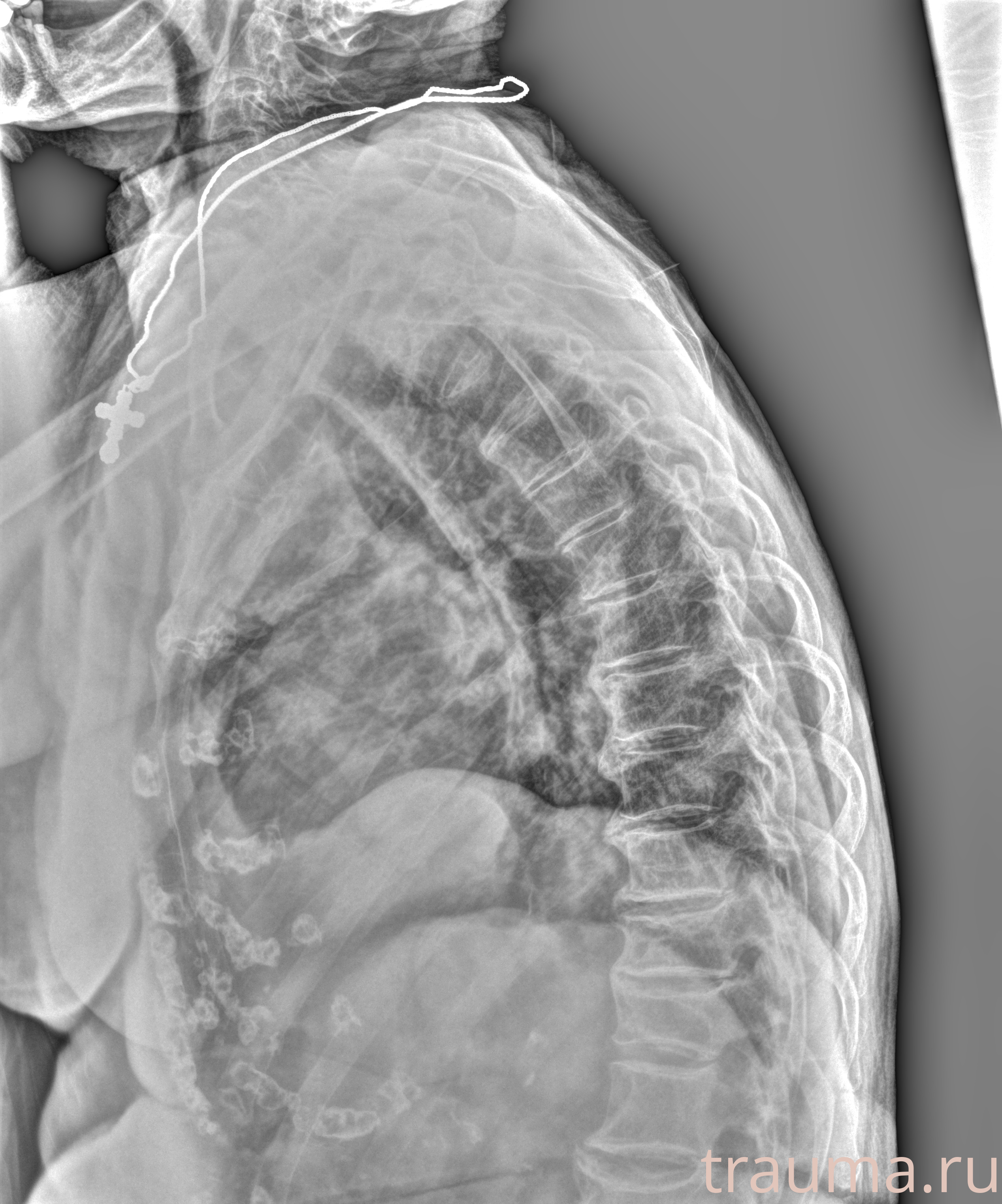 Рентген на дому: по вашему адресу приезжает врач-рентгенолог, травматолог-ортопед с мобильным рентгеновским аппаратом, проводит диагностику травмы или заболевания, делает необходимые рентгенограммы, дает рекомендации по дальнейшему лечению. Получить качественные снимки в домашних условиях возможно благодаря уникальной методике, разработанной МосРентген Центром для института  Склифосовского