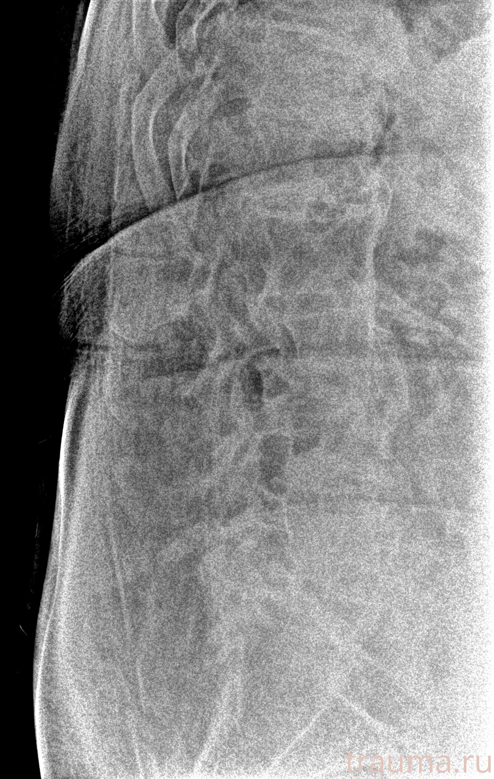 Рентген на дому: по вашему адресу приезжает врач-рентгенолог, травматолог-ортопед с мобильным рентгеновским аппаратом, проводит диагностику травмы или заболевания, делает необходимые рентгенограммы, дает рекомендации по дальнейшему лечению. Получить качественные снимки в домашних условиях возможно благодаря уникальной методике, разработанной МосРентген Центром для института  Склифосовского