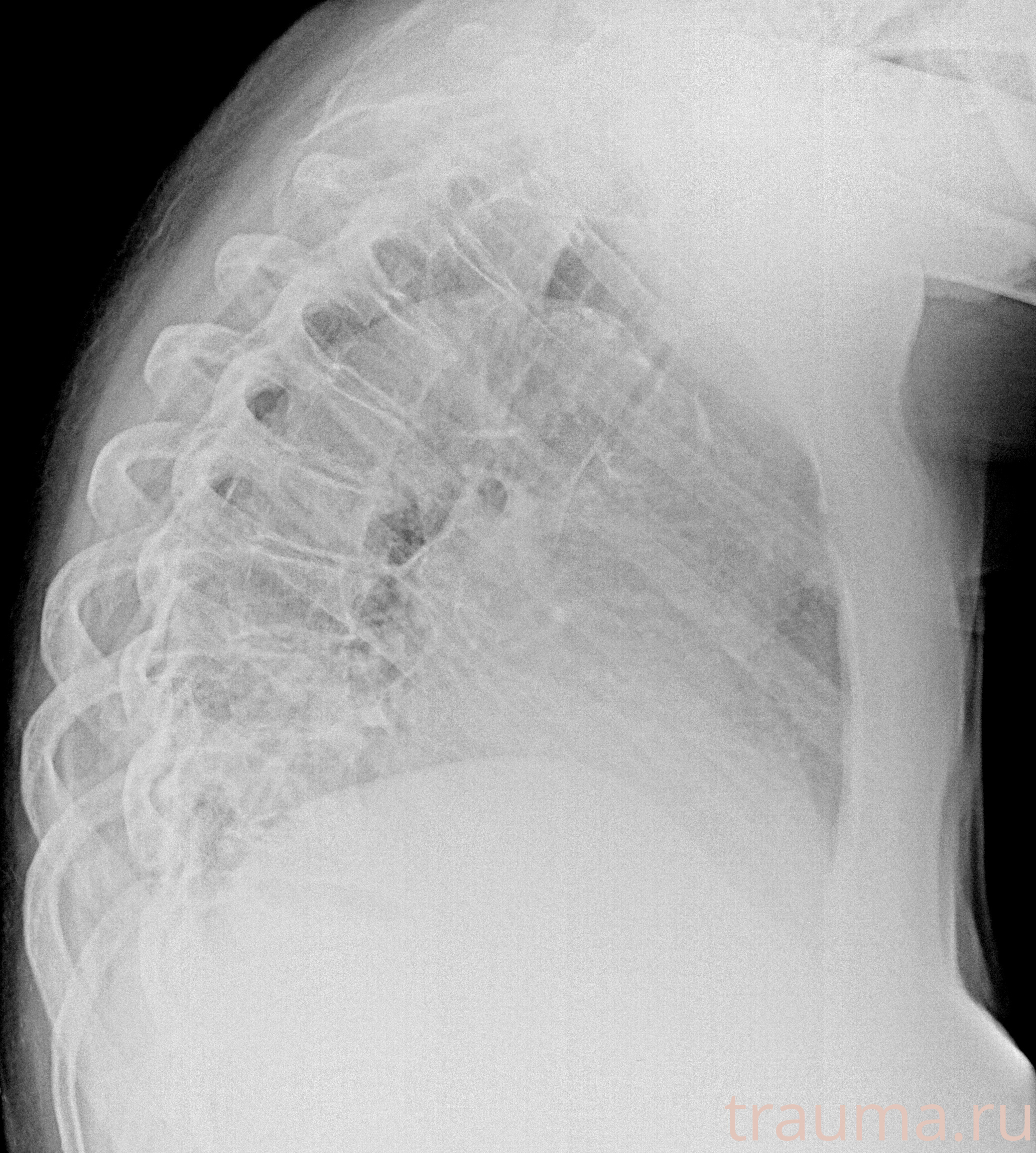 Рентген на дому: по вашему адресу приезжает врач-рентгенолог, травматолог-ортопед с мобильным рентгеновским аппаратом, проводит диагностику травмы или заболевания, делает необходимые рентгенограммы, дает рекомендации по дальнейшему лечению. Получить качественные снимки в домашних условиях возможно благодаря уникальной методике, разработанной МосРентген Центром для института  Склифосовского