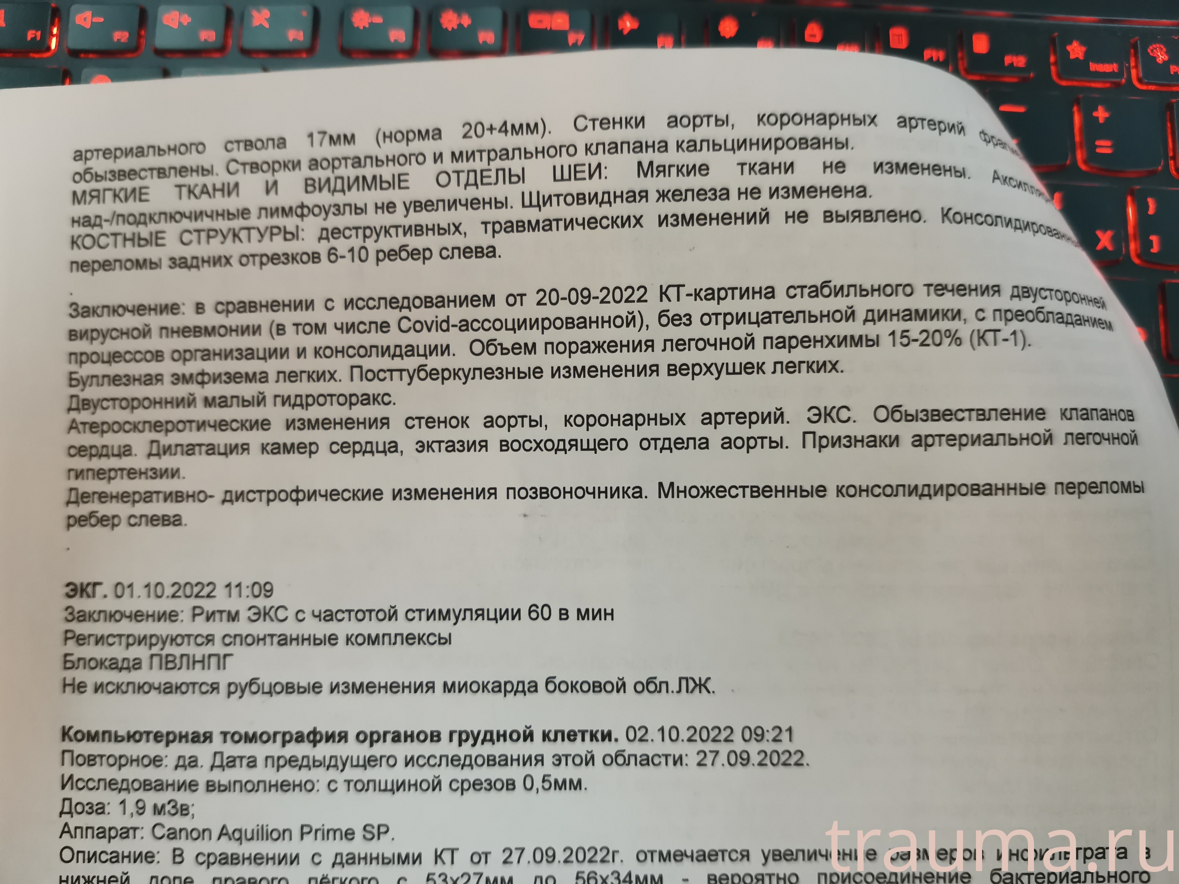 Рентген на дому: по вашему адресу приезжает врач-рентгенолог, травматолог-ортопед с мобильным рентгеновским аппаратом, проводит диагностику травмы или заболевания, делает необходимые рентгенограммы, дает рекомендации по дальнейшему лечению. Получить качественные снимки в домашних условиях возможно благодаря уникальной методике, разработанной МосРентген Центром для института  Склифосовского