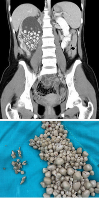 Опасный эксперимент над организмом