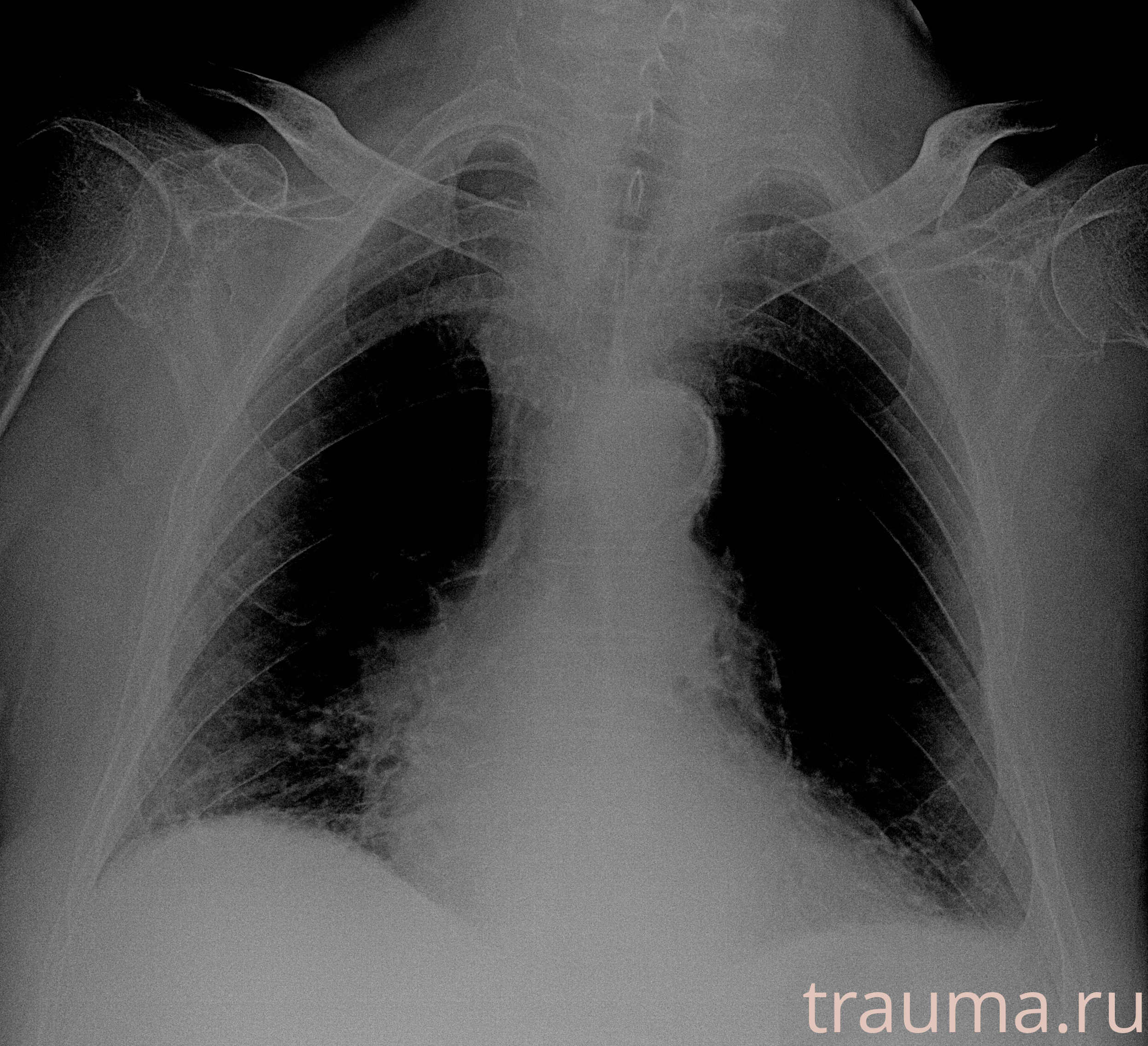 Рентген на дому: по вашему адресу приезжает врач-рентгенолог, травматолог-ортопед с мобильным рентгеновским аппаратом, проводит диагностику травмы или заболевания, делает необходимые рентгенограммы, дает рекомендации по дальнейшему лечению. Получить качественные снимки в домашних условиях возможно благодаря уникальной методике, разработанной МосРентген Центром для института  Склифосовского