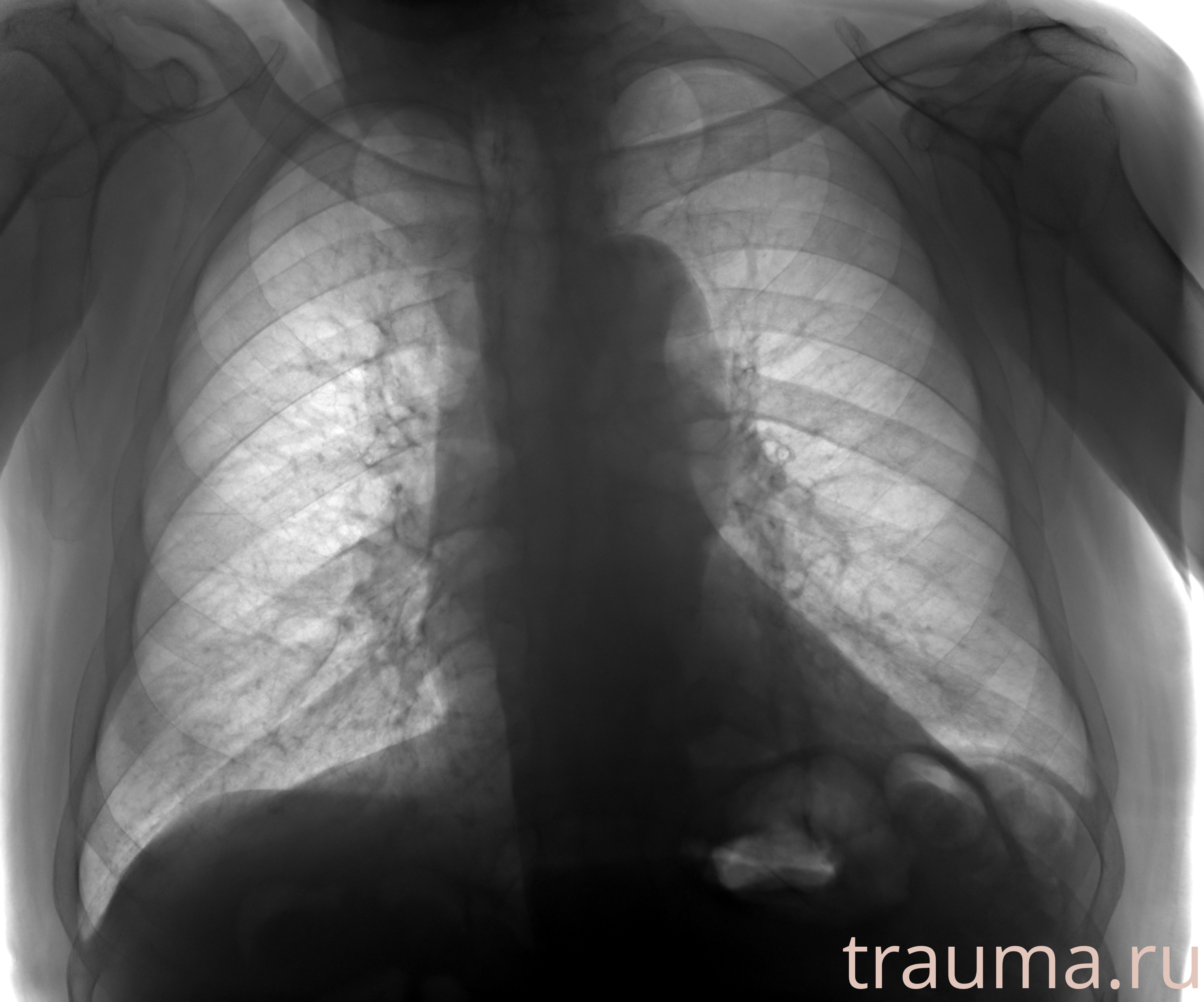 Рентген на дому: по вашему адресу приезжает врач-рентгенолог, травматолог-ортопед с мобильным рентгеновским аппаратом, проводит диагностику травмы или заболевания, делает необходимые рентгенограммы, дает рекомендации по дальнейшему лечению. Получить качественные снимки в домашних условиях возможно благодаря уникальной методике, разработанной МосРентген Центром для института  Склифосовского