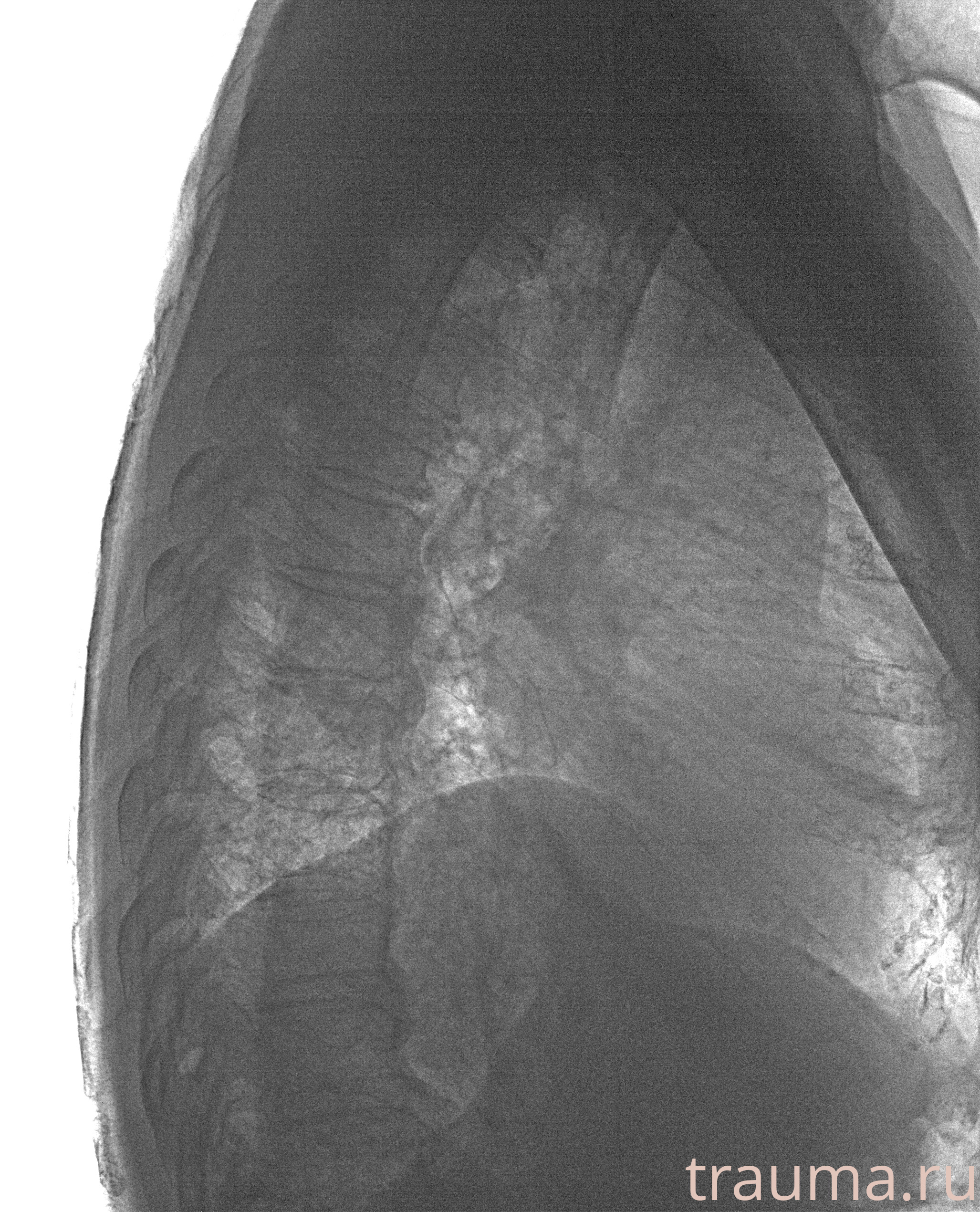 Рентген на дому: по вашему адресу приезжает врач-рентгенолог, травматолог-ортопед с мобильным рентгеновским аппаратом, проводит диагностику травмы или заболевания, делает необходимые рентгенограммы, дает рекомендации по дальнейшему лечению. Получить качественные снимки в домашних условиях возможно благодаря уникальной методике, разработанной МосРентген Центром для института  Склифосовского