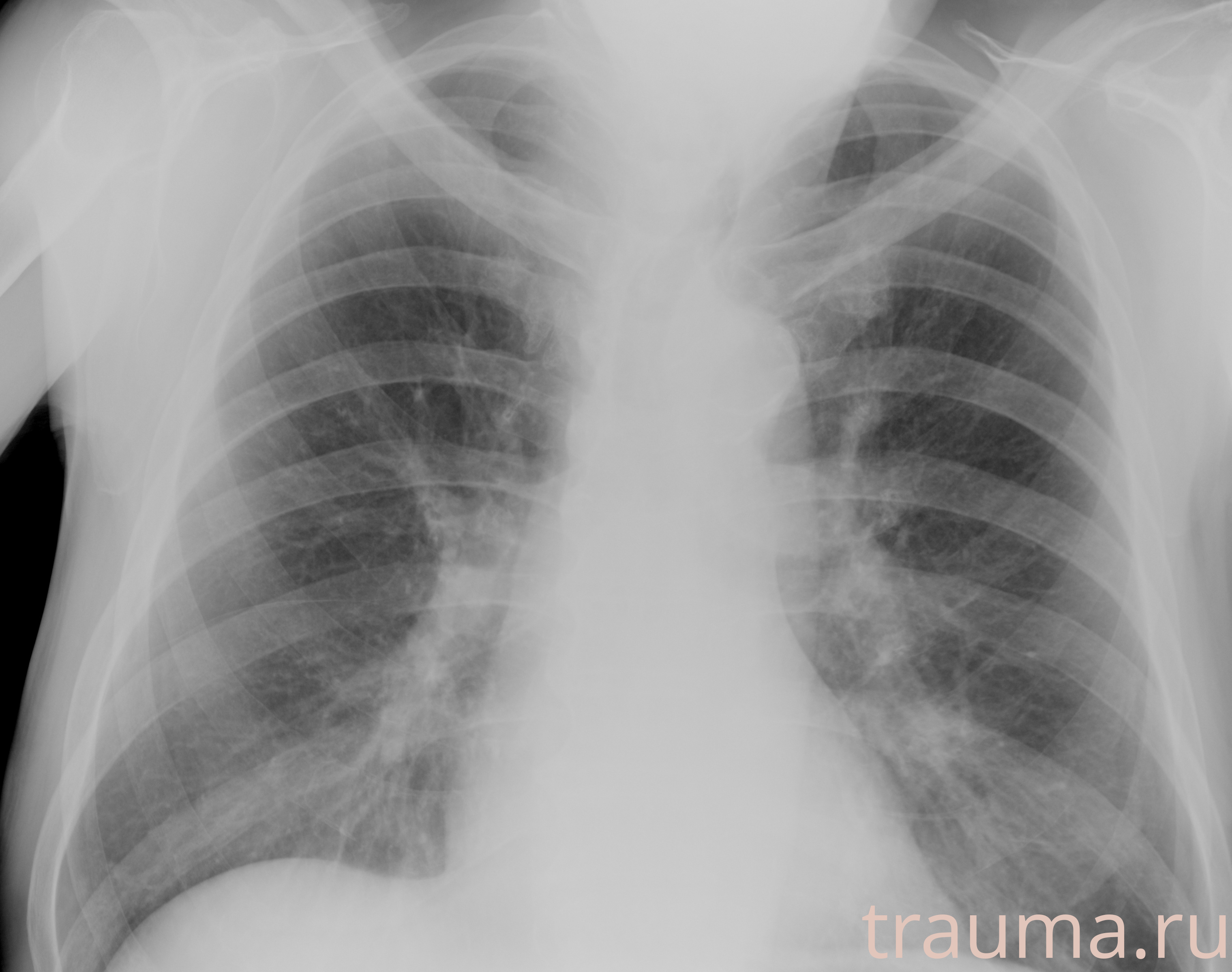 Рентген на дому: по вашему адресу приезжает врач-рентгенолог, травматолог-ортопед с мобильным рентгеновским аппаратом, проводит диагностику травмы или заболевания, делает необходимые рентгенограммы, дает рекомендации по дальнейшему лечению. Получить качественные снимки в домашних условиях возможно благодаря уникальной методике, разработанной МосРентген Центром для института  Склифосовского