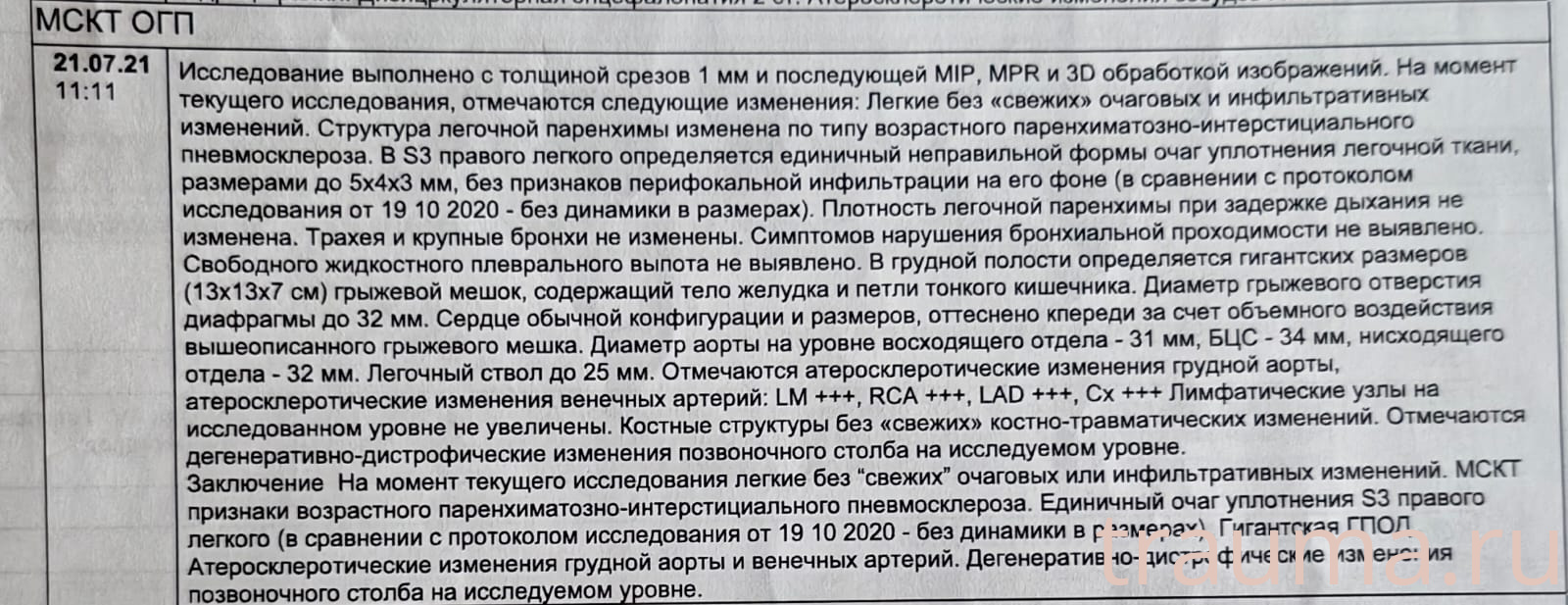 Рентген на дому: по вашему адресу приезжает врач-рентгенолог, травматолог-ортопед с мобильным рентгеновским аппаратом, проводит диагностику травмы или заболевания, делает необходимые рентгенограммы, дает рекомендации по дальнейшему лечению. Получить качественные снимки в домашних условиях возможно благодаря уникальной методике, разработанной МосРентген Центром для института  Склифосовского