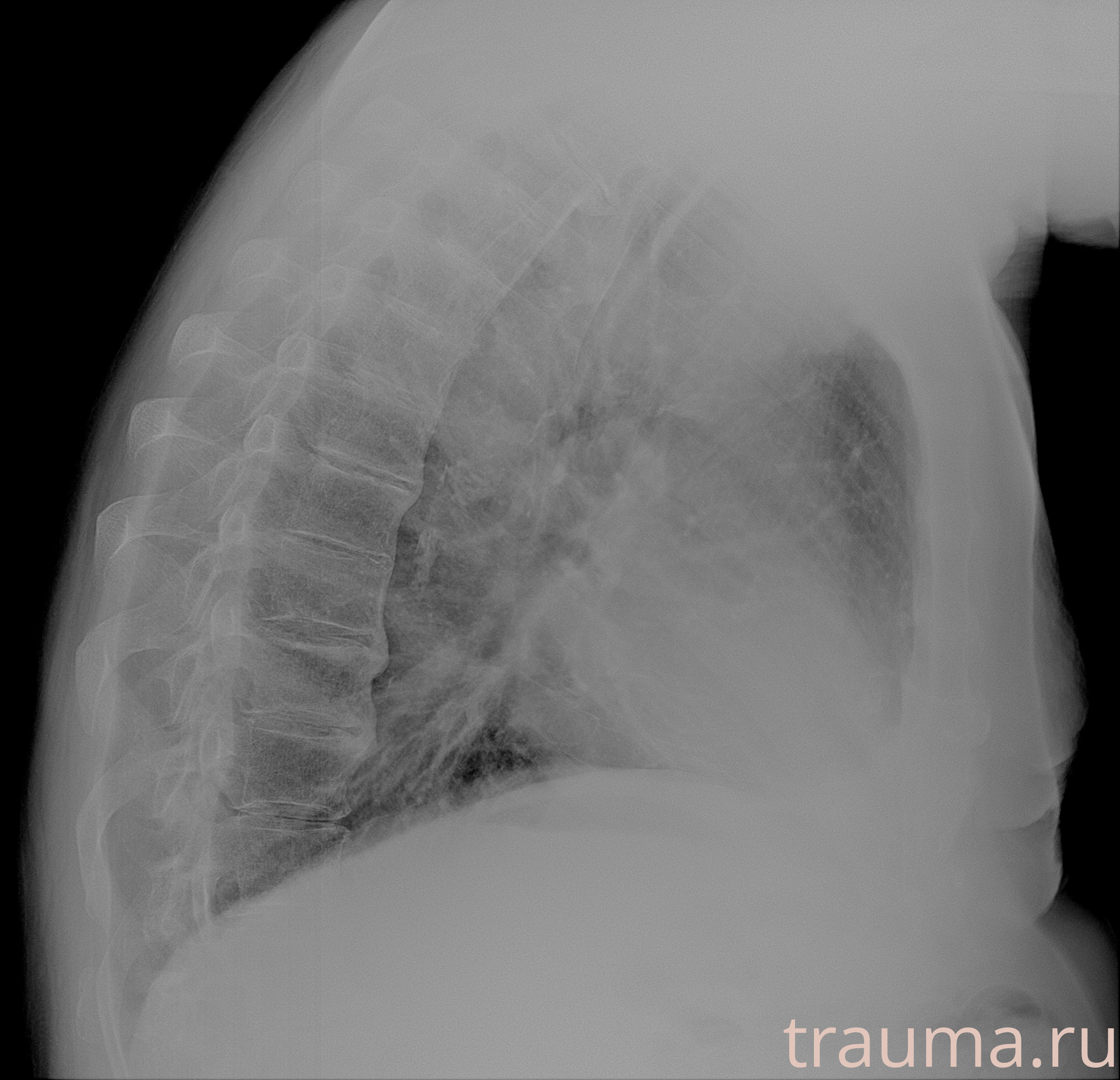 Рентген на дому: по вашему адресу приезжает врач-рентгенолог, травматолог-ортопед с мобильным рентгеновским аппаратом, проводит диагностику травмы или заболевания, делает необходимые рентгенограммы, дает рекомендации по дальнейшему лечению. Получить качественные снимки в домашних условиях возможно благодаря уникальной методике, разработанной МосРентген Центром для института  Склифосовского