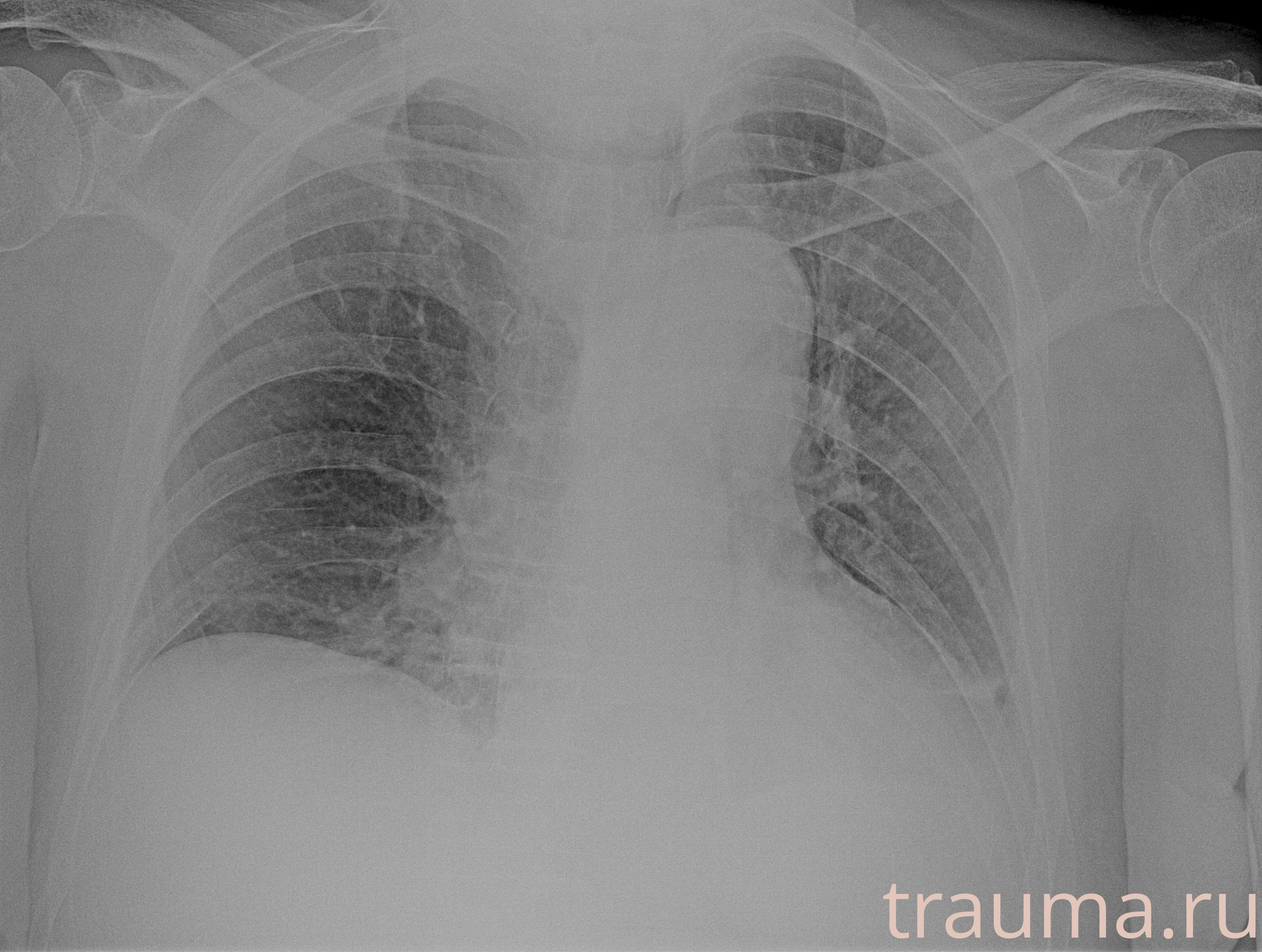 Рентген на дому: по вашему адресу приезжает врач-рентгенолог, травматолог-ортопед с мобильным рентгеновским аппаратом, проводит диагностику травмы или заболевания, делает необходимые рентгенограммы, дает рекомендации по дальнейшему лечению. Получить качественные снимки в домашних условиях возможно благодаря уникальной методике, разработанной МосРентген Центром для института  Склифосовского