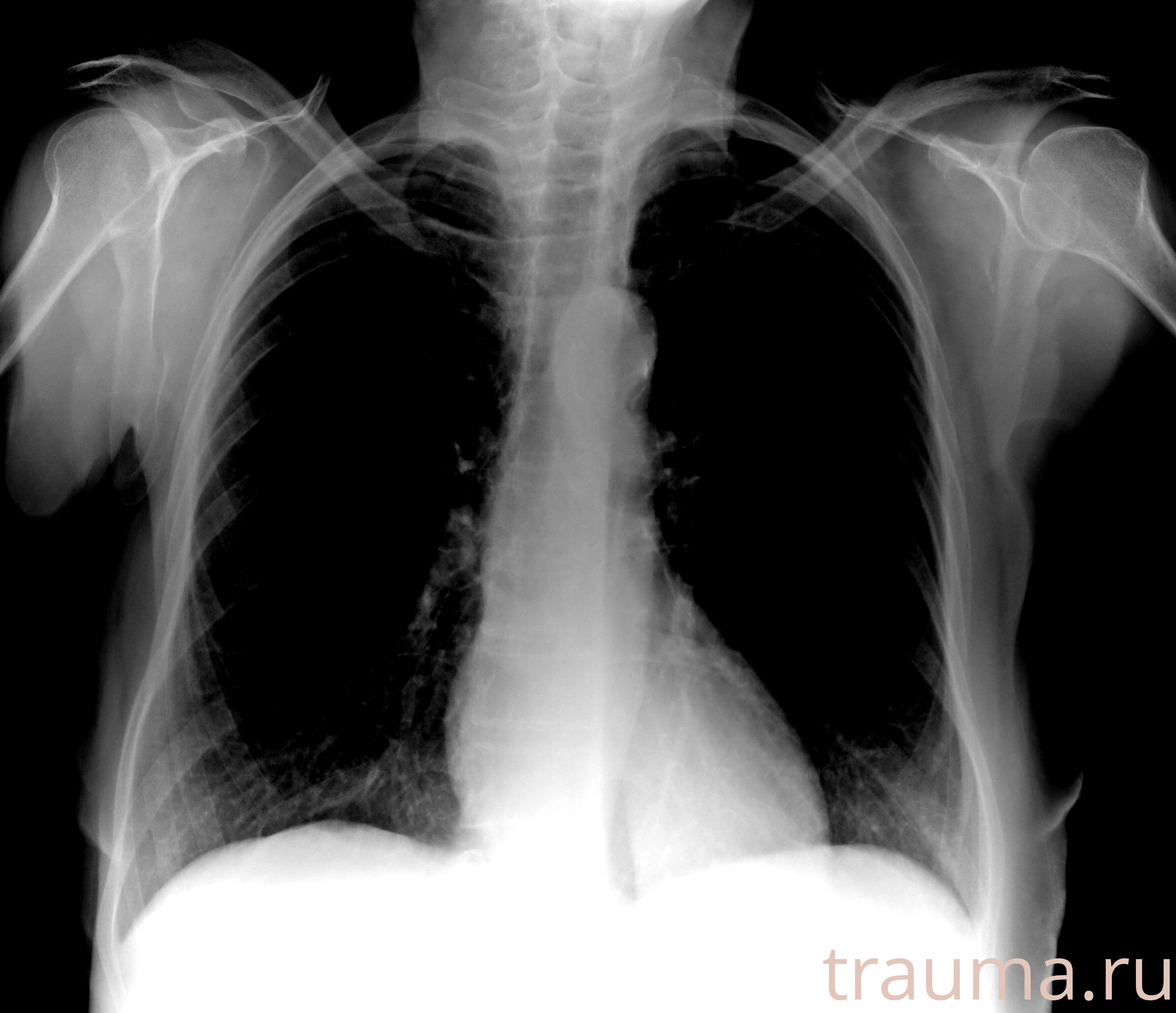 Рентген на дому: по вашему адресу приезжает врач-рентгенолог, травматолог-ортопед с мобильным рентгеновским аппаратом, проводит диагностику травмы или заболевания, делает необходимые рентгенограммы, дает рекомендации по дальнейшему лечению. Получить качественные снимки в домашних условиях возможно благодаря уникальной методике, разработанной МосРентген Центром для института  Склифосовского