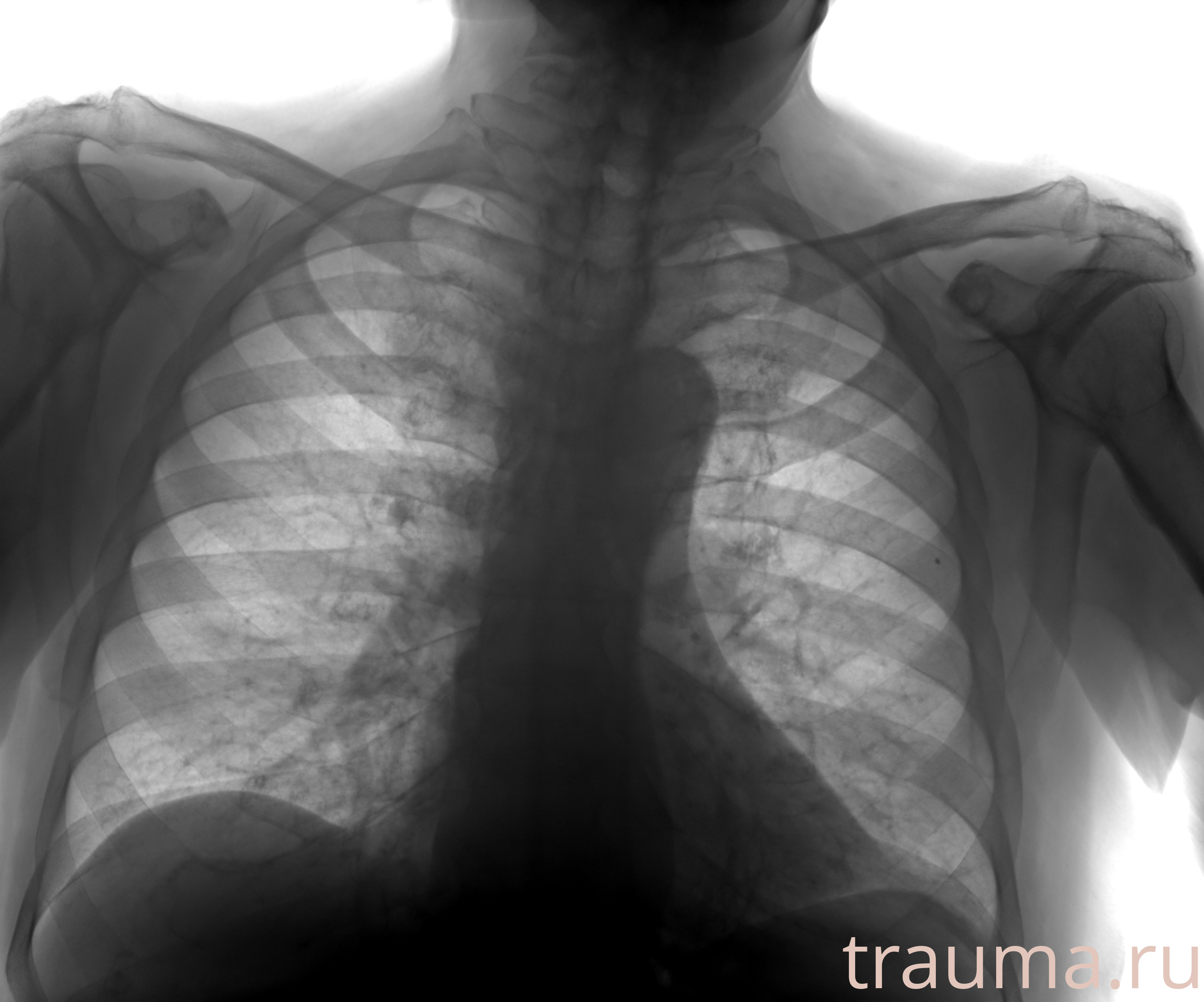 Рентген на дому: по вашему адресу приезжает врач-рентгенолог, травматолог-ортопед с мобильным рентгеновским аппаратом, проводит диагностику травмы или заболевания, делает необходимые рентгенограммы, дает рекомендации по дальнейшему лечению. Получить качественные снимки в домашних условиях возможно благодаря уникальной методике, разработанной МосРентген Центром для института  Склифосовского