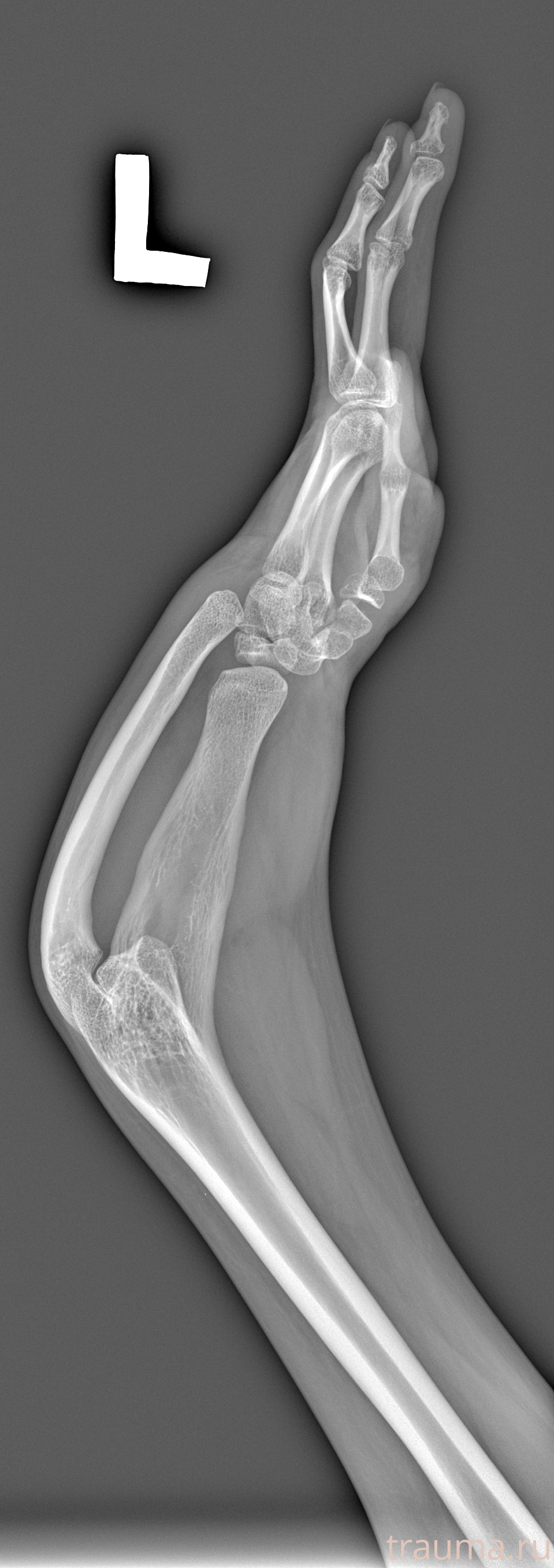 Рентген на дому: по вашему адресу приезжает врач-рентгенолог, травматолог-ортопед с мобильным рентгеновским аппаратом, проводит диагностику травмы или заболевания, делает необходимые рентгенограммы, дает рекомендации по дальнейшему лечению. Получить качественные снимки в домашних условиях возможно благодаря уникальной методике, разработанной МосРентген Центром для института  Склифосовского