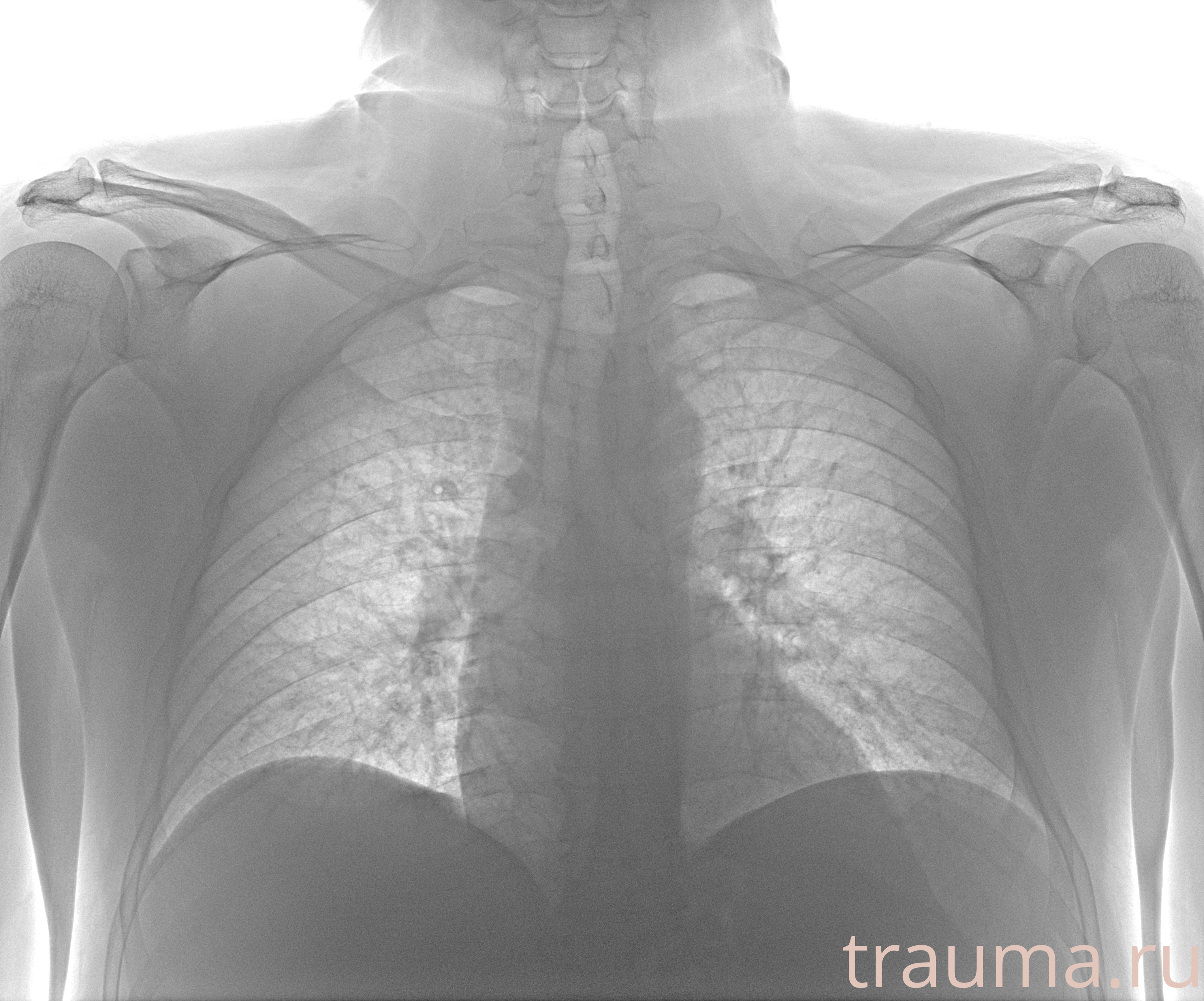 Рентген на дому: по вашему адресу приезжает врач-рентгенолог, травматолог-ортопед с мобильным рентгеновским аппаратом, проводит диагностику травмы или заболевания, делает необходимые рентгенограммы, дает рекомендации по дальнейшему лечению. Получить качественные снимки в домашних условиях возможно благодаря уникальной методике, разработанной МосРентген Центром для института  Склифосовского