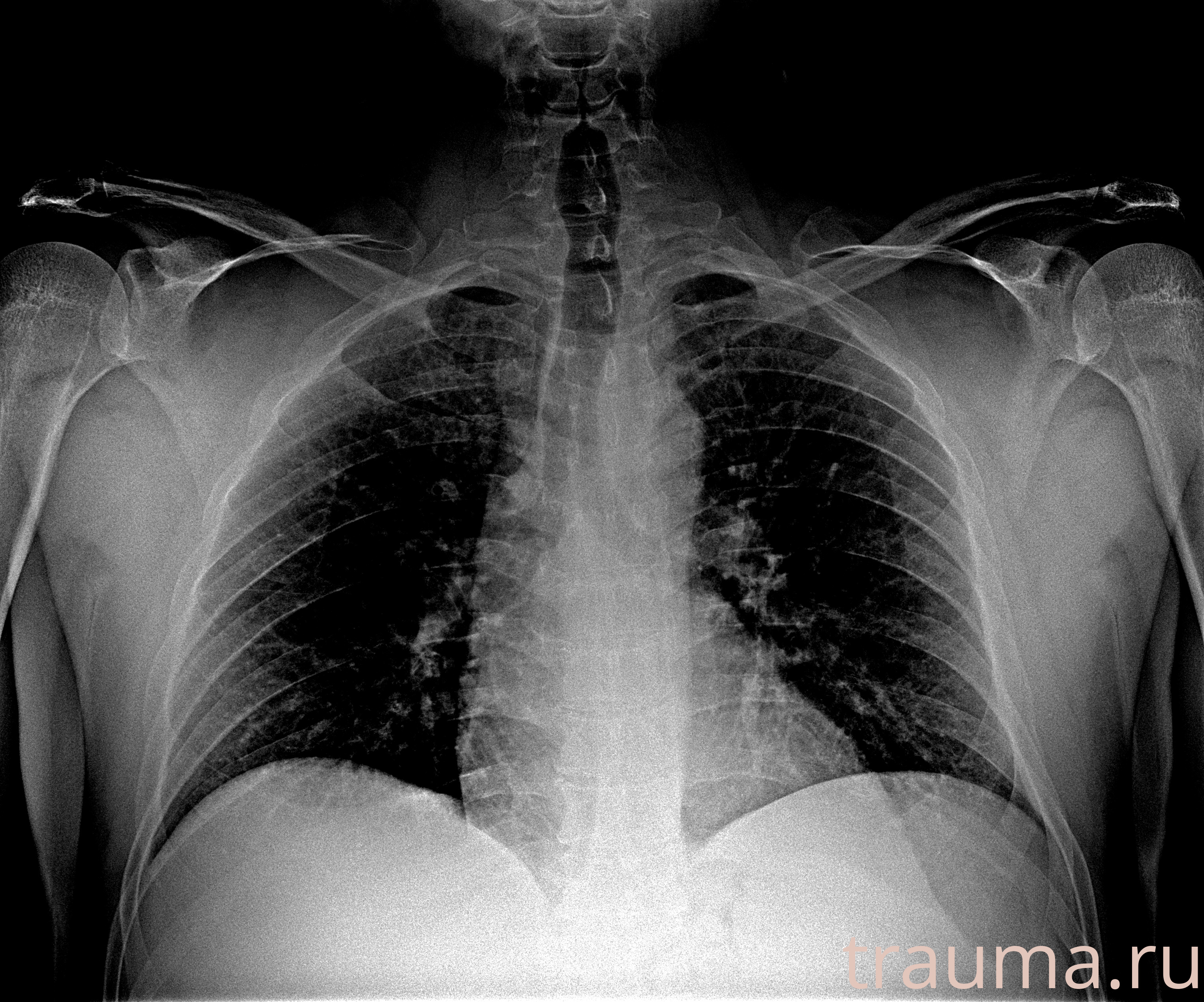 Рентген на дому: по вашему адресу приезжает врач-рентгенолог, травматолог-ортопед с мобильным рентгеновским аппаратом, проводит диагностику травмы или заболевания, делает необходимые рентгенограммы, дает рекомендации по дальнейшему лечению. Получить качественные снимки в домашних условиях возможно благодаря уникальной методике, разработанной МосРентген Центром для института  Склифосовского