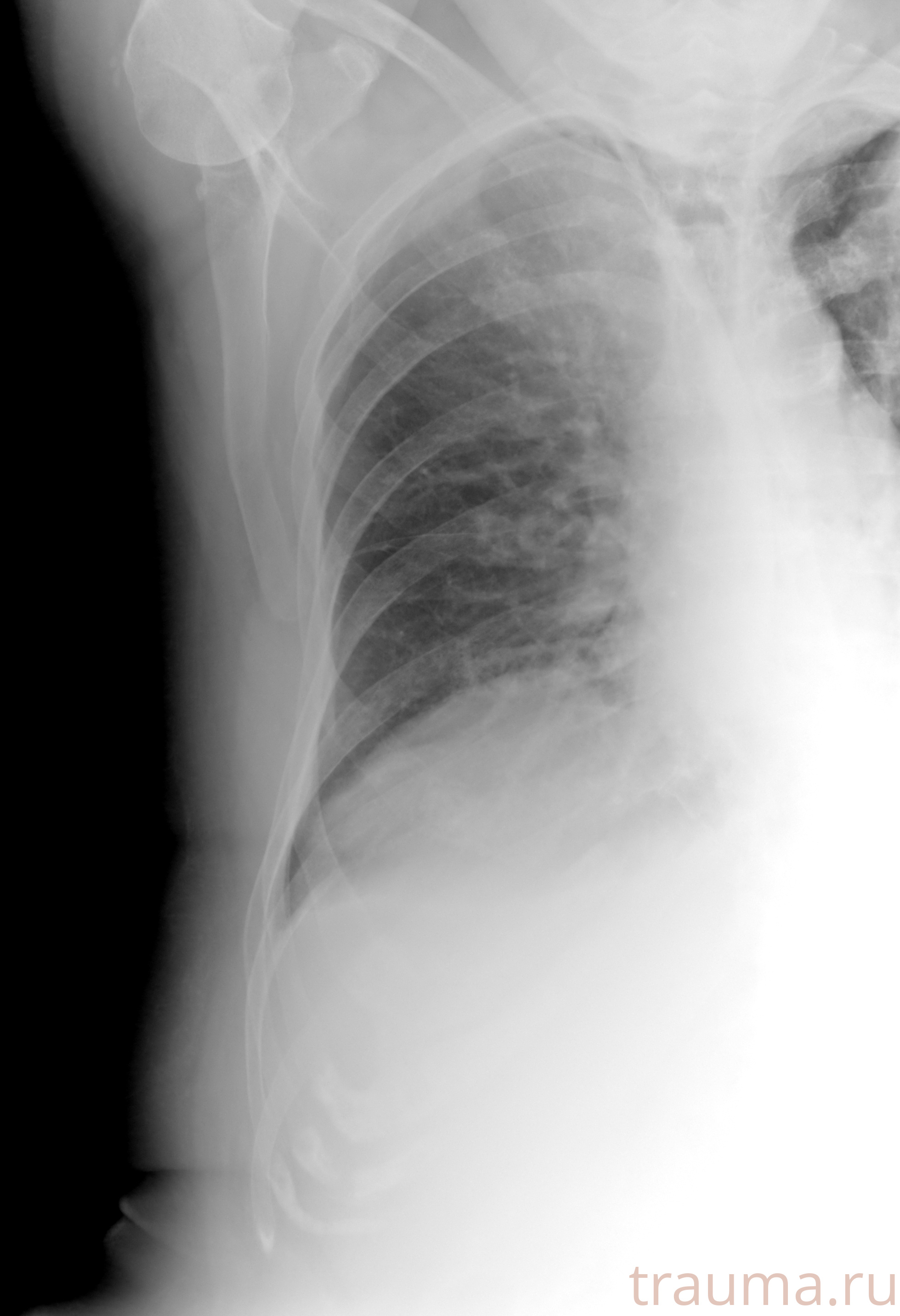 Рентген на дому: по вашему адресу приезжает врач-рентгенолог, травматолог-ортопед с мобильным рентгеновским аппаратом, проводит диагностику травмы или заболевания, делает необходимые рентгенограммы, дает рекомендации по дальнейшему лечению. Получить качественные снимки в домашних условиях возможно благодаря уникальной методике, разработанной МосРентген Центром для института  Склифосовского