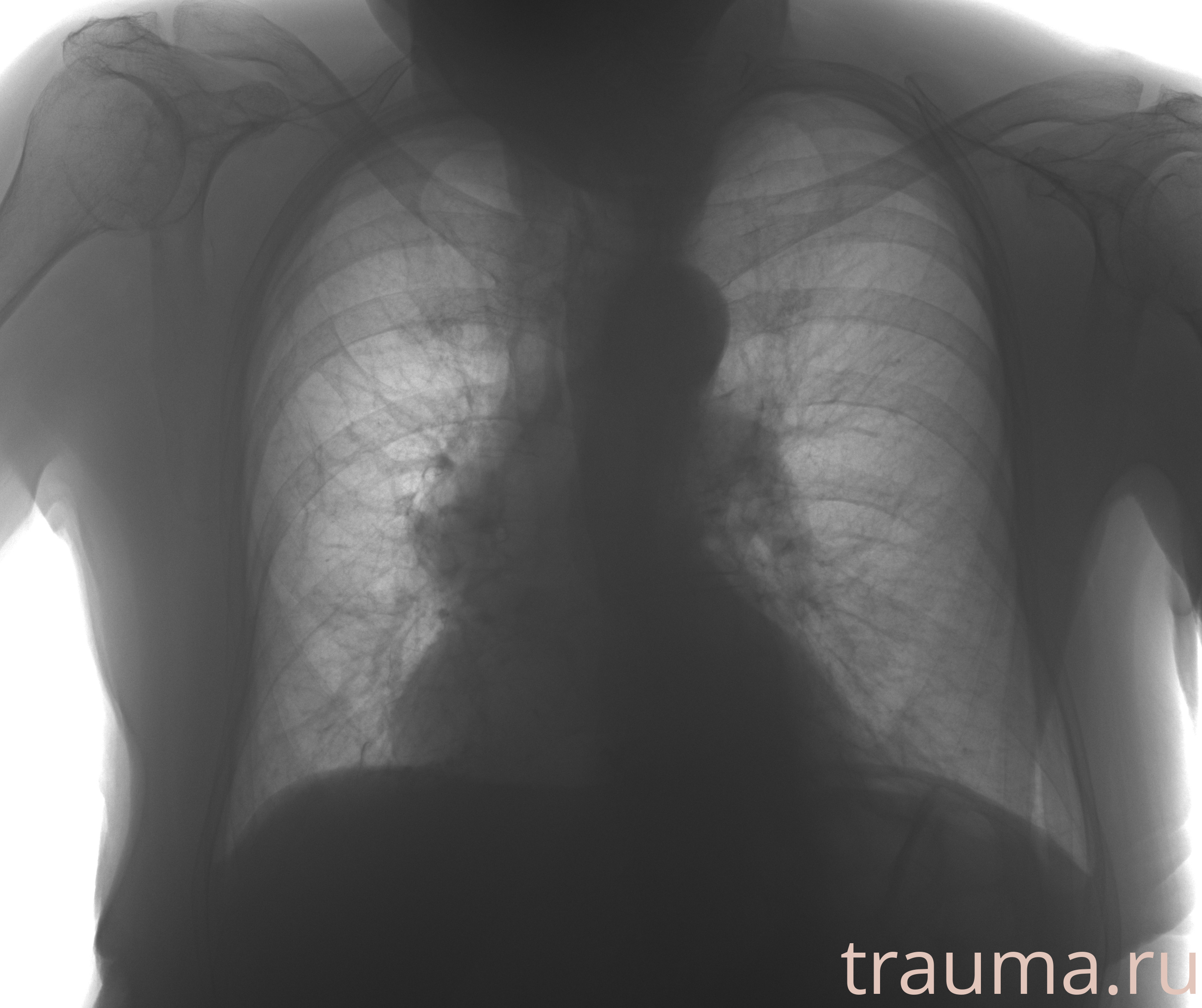 Рентген на дому: по вашему адресу приезжает врач-рентгенолог, травматолог-ортопед с мобильным рентгеновским аппаратом, проводит диагностику травмы или заболевания, делает необходимые рентгенограммы, дает рекомендации по дальнейшему лечению. Получить качественные снимки в домашних условиях возможно благодаря уникальной методике, разработанной МосРентген Центром для института  Склифосовского