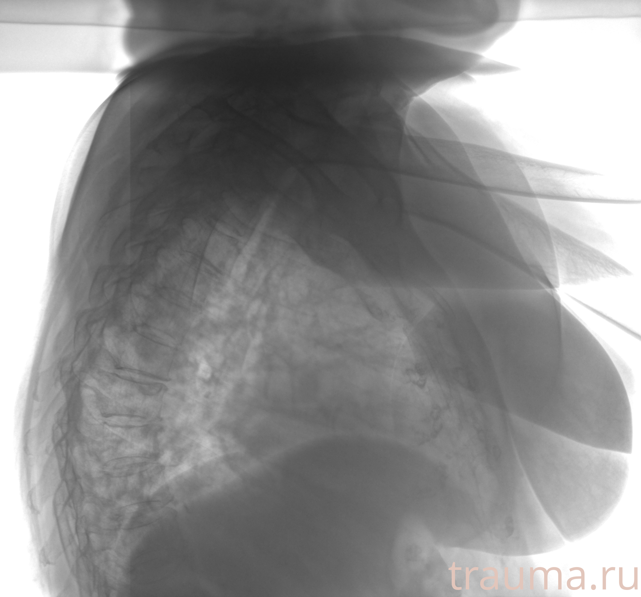 Рентген на дому: по вашему адресу приезжает врач-рентгенолог, травматолог-ортопед с мобильным рентгеновским аппаратом, проводит диагностику травмы или заболевания, делает необходимые рентгенограммы, дает рекомендации по дальнейшему лечению. Получить качественные снимки в домашних условиях возможно благодаря уникальной методике, разработанной МосРентген Центром для института  Склифосовского