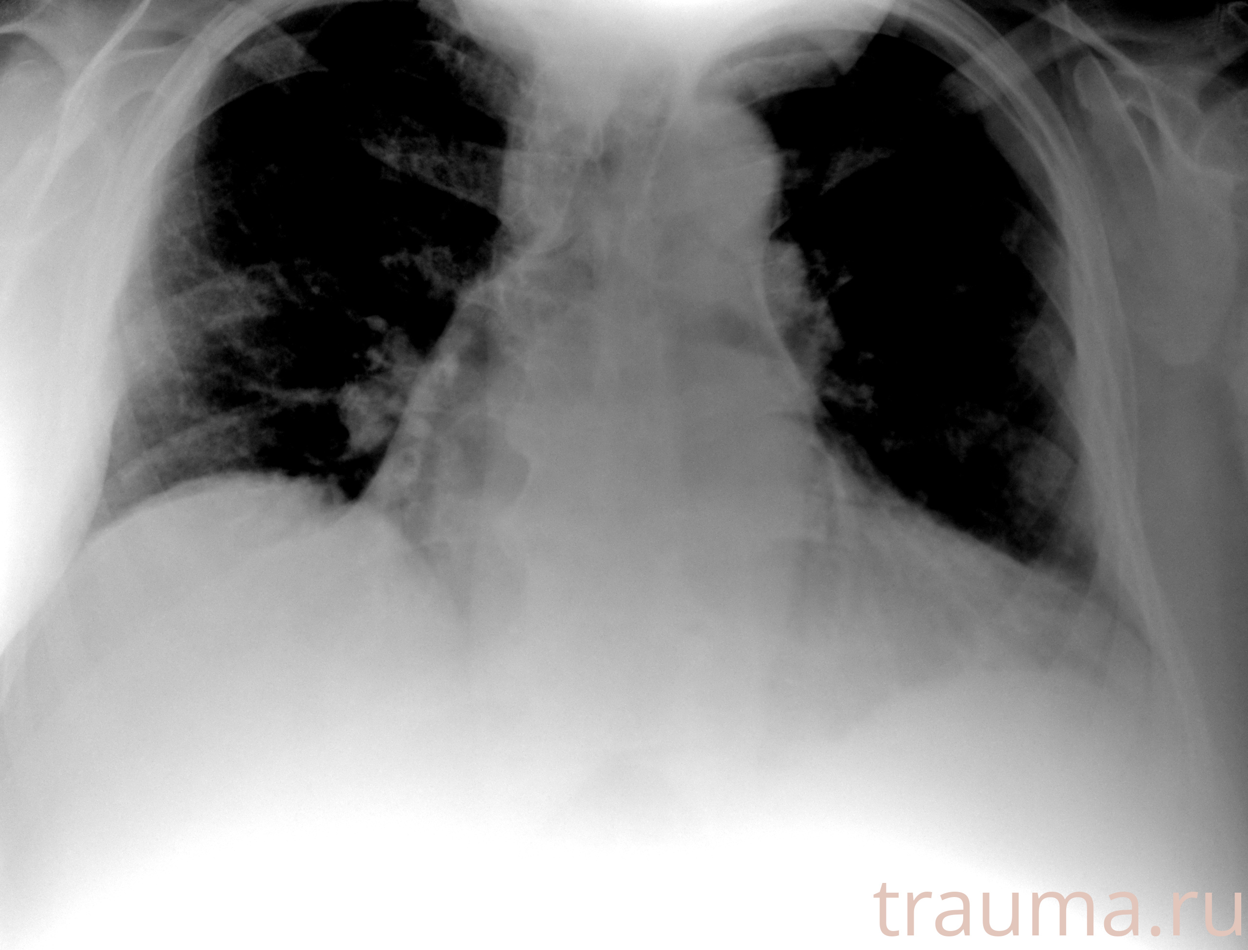 Рентген на дому: по вашему адресу приезжает врач-рентгенолог, травматолог-ортопед с мобильным рентгеновским аппаратом, проводит диагностику травмы или заболевания, делает необходимые рентгенограммы, дает рекомендации по дальнейшему лечению. Получить качественные снимки в домашних условиях возможно благодаря уникальной методике, разработанной МосРентген Центром для института  Склифосовского