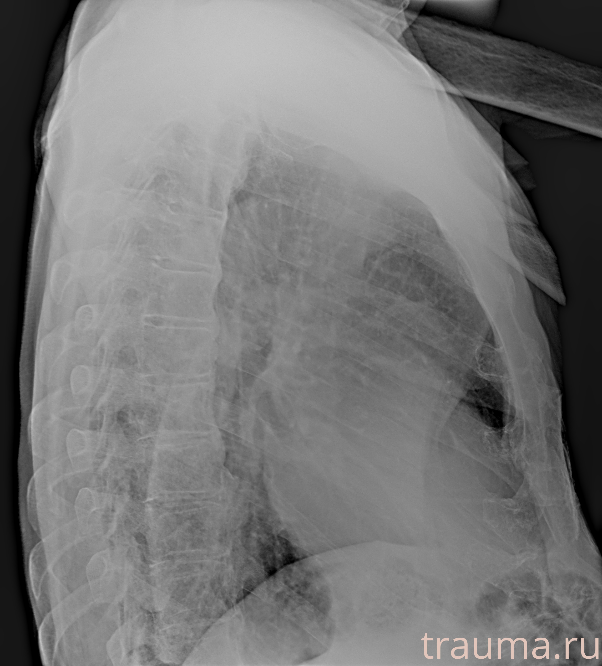 Рентген на дому: по вашему адресу приезжает врач-рентгенолог, травматолог-ортопед с мобильным рентгеновским аппаратом, проводит диагностику травмы или заболевания, делает необходимые рентгенограммы, дает рекомендации по дальнейшему лечению. Получить качественные снимки в домашних условиях возможно благодаря уникальной методике, разработанной МосРентген Центром для института  Склифосовского