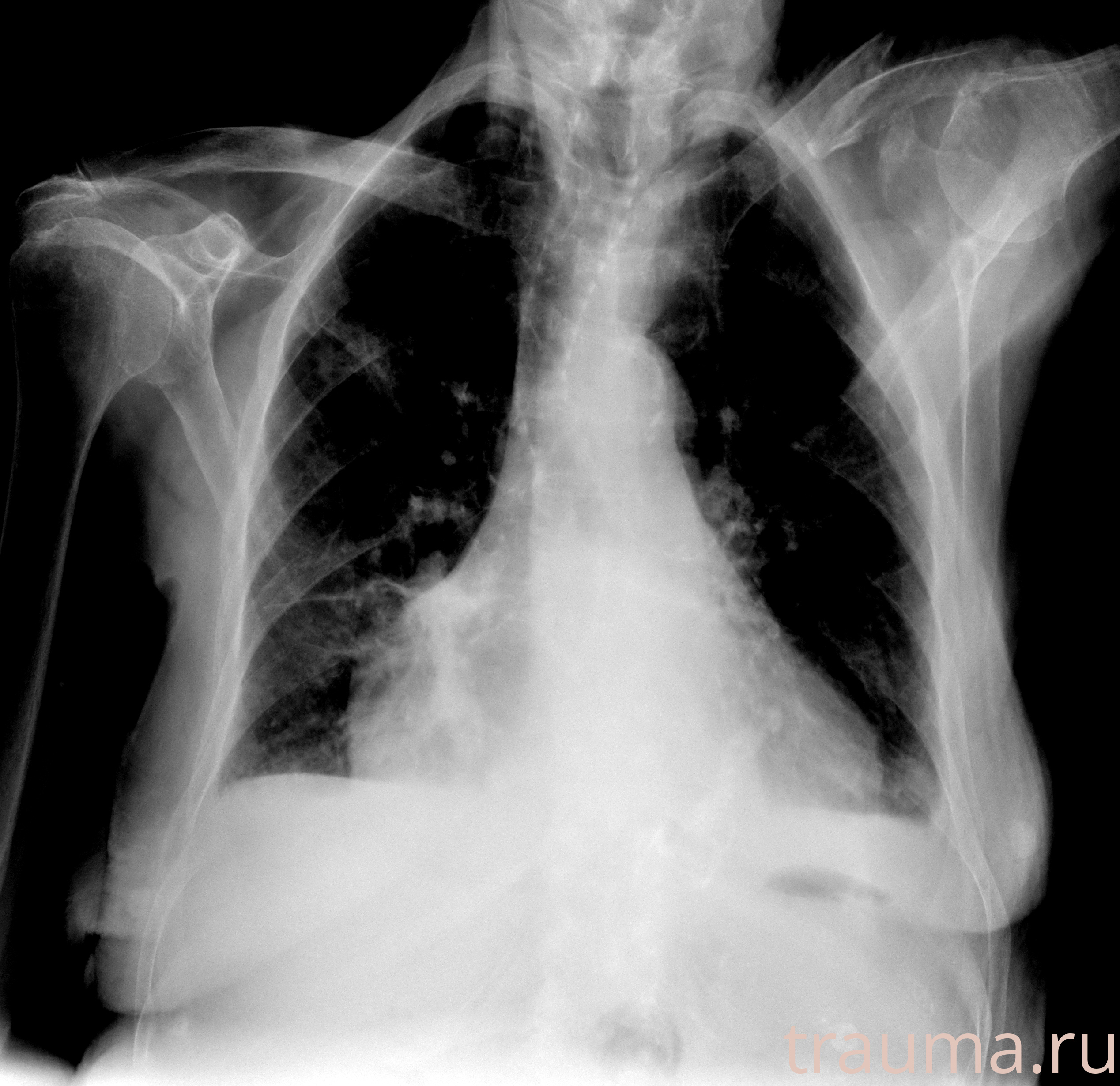 Рентген на дому: по вашему адресу приезжает врач-рентгенолог, травматолог-ортопед с мобильным рентгеновским аппаратом, проводит диагностику травмы или заболевания, делает необходимые рентгенограммы, дает рекомендации по дальнейшему лечению. Получить качественные снимки в домашних условиях возможно благодаря уникальной методике, разработанной МосРентген Центром для института  Склифосовского